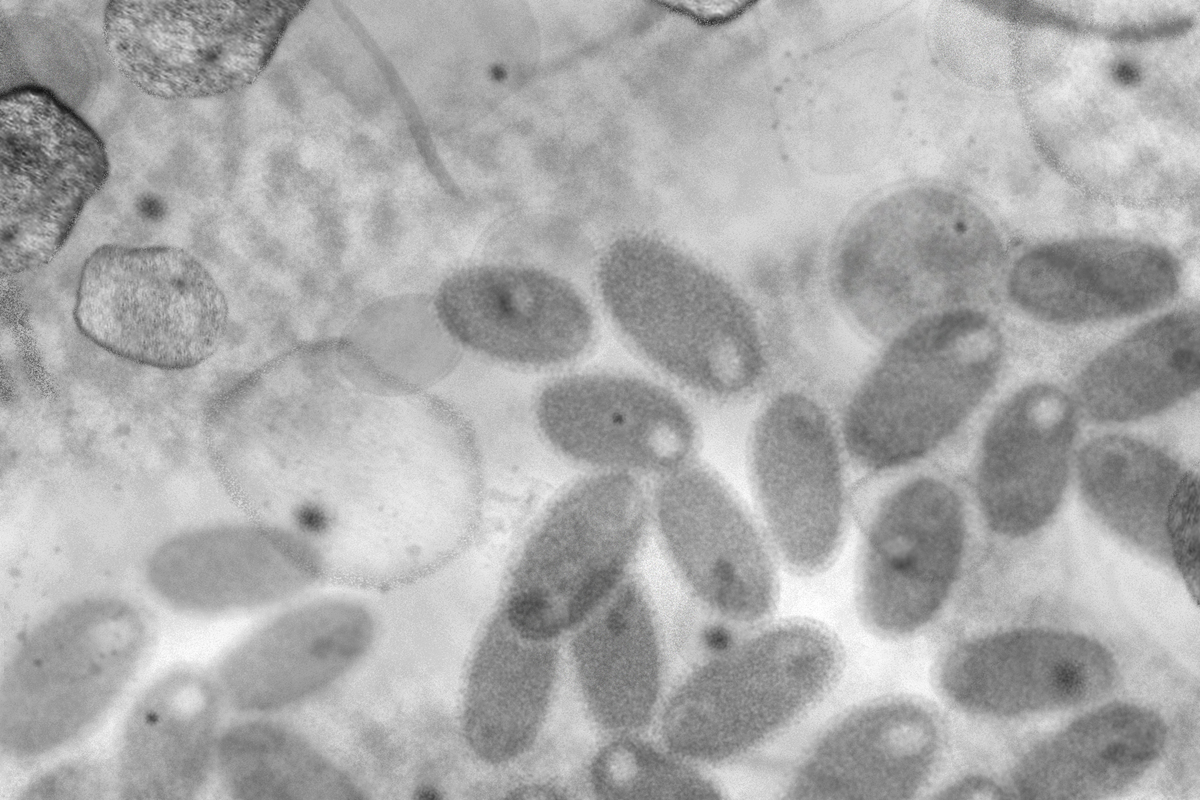 革兰氏阴性细菌外膜的β-桶形结构