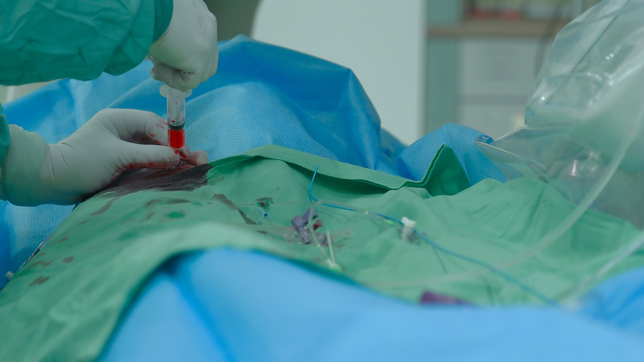vascular surgery.