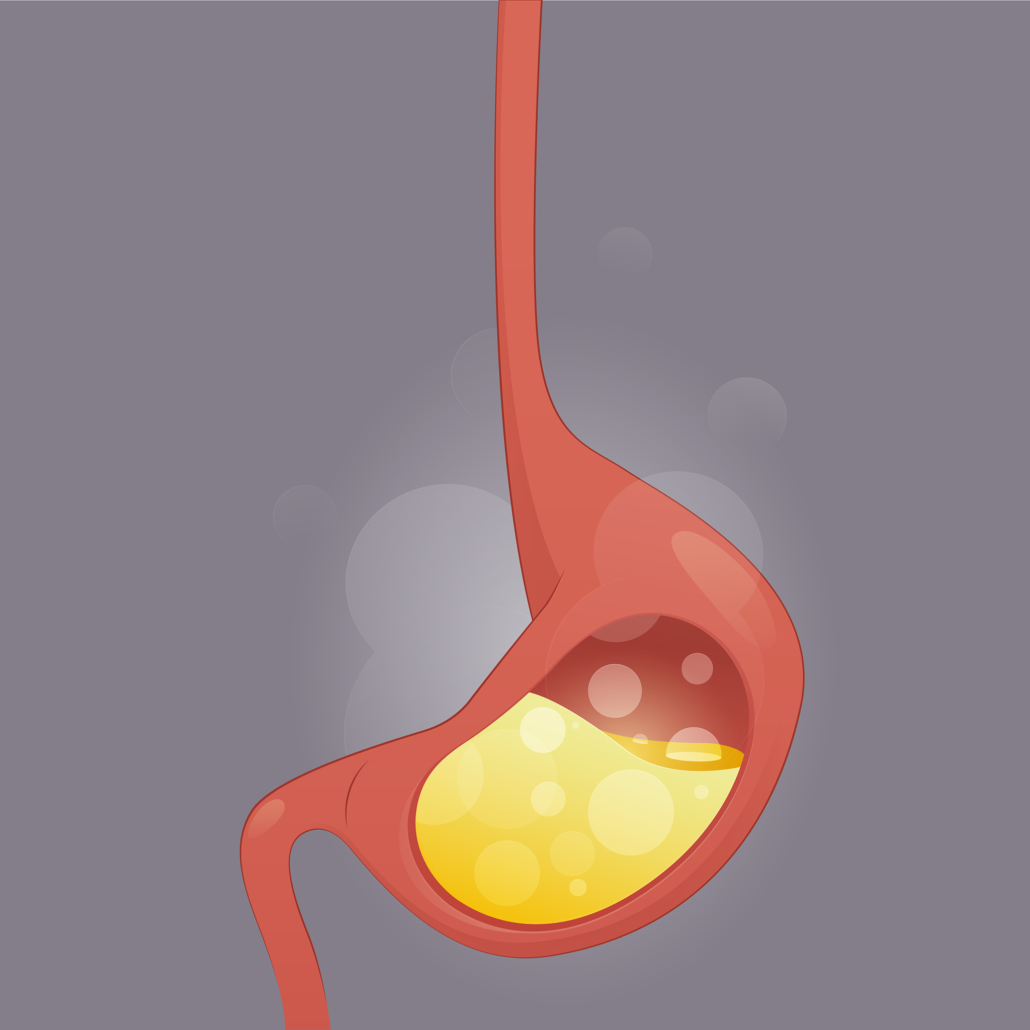 我经常一吃多就会胃酸怎么治疗？