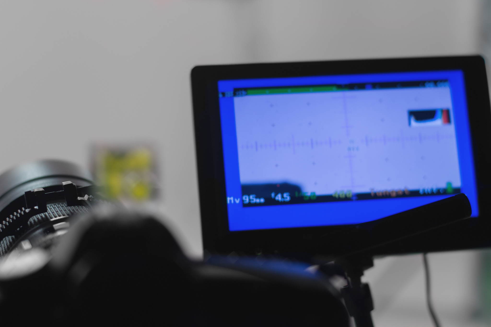 光学相干层析成像 血糖