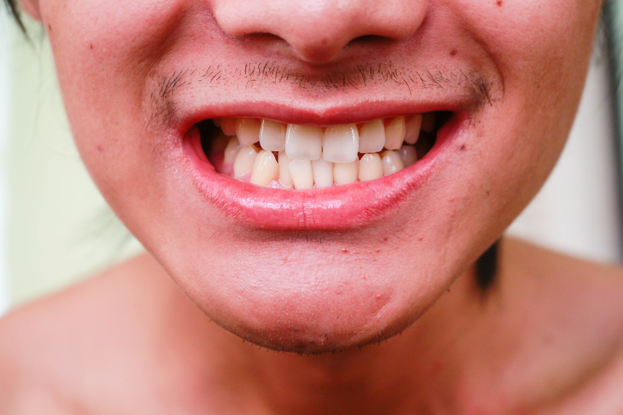 广安职业技术学院口腔修复专业