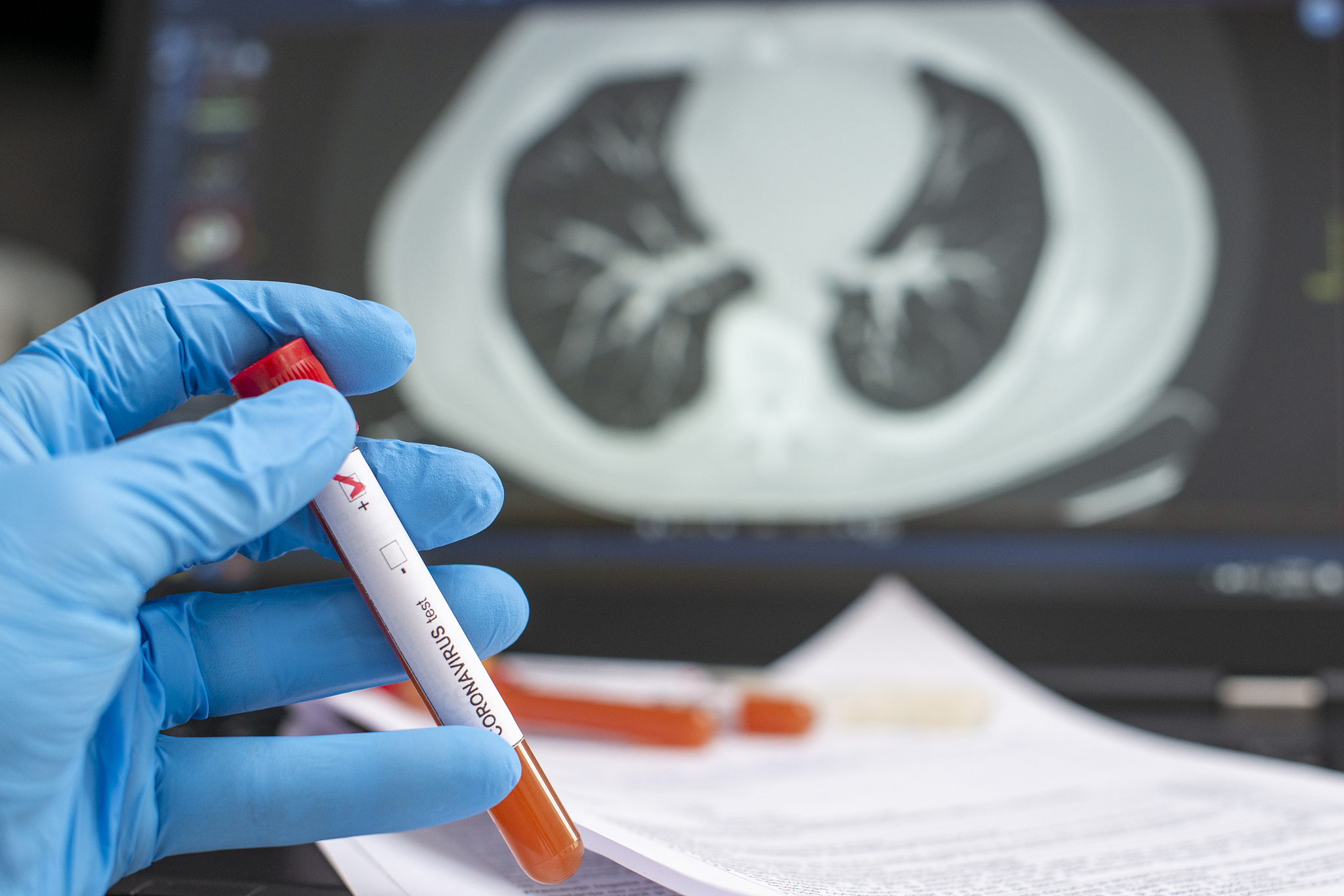 虽然吴主任说的很有道理不过这个年轻人并没有导师说的那些情况而且肺纤维化却在逐年增加真是非常奇怪。