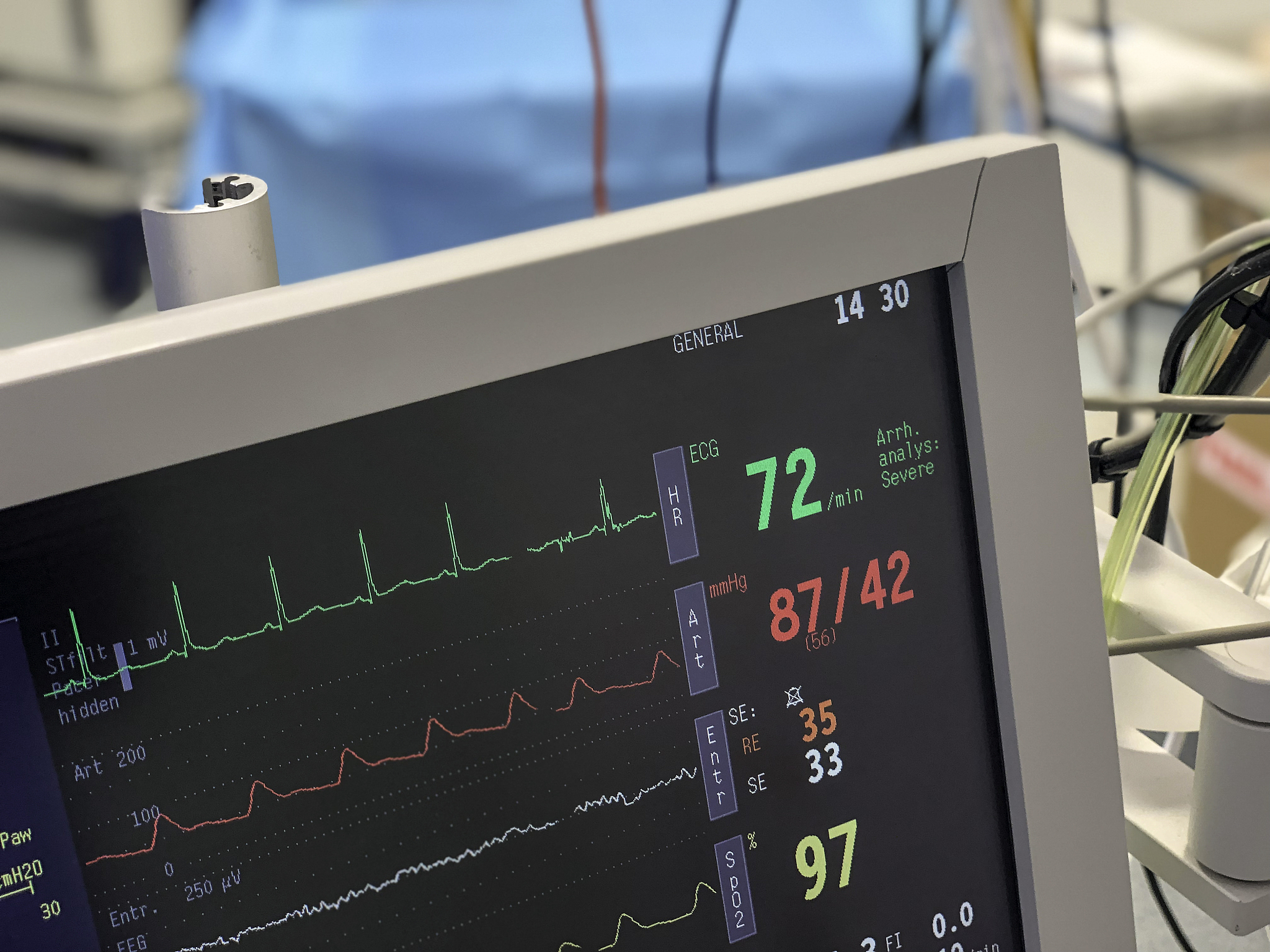 回归运动预测准确度：10个数据集评估结果
