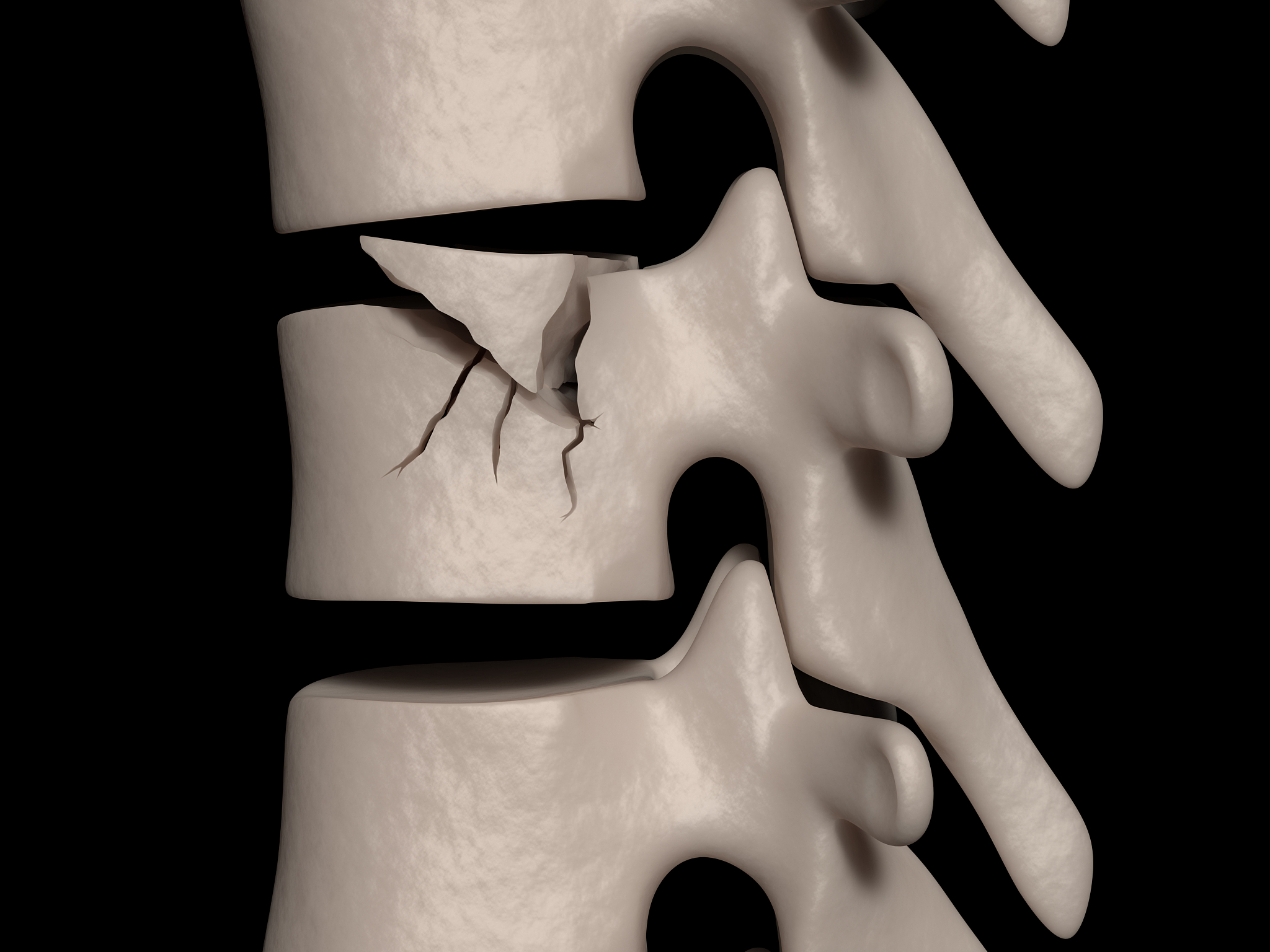 骨质疏松症动物模型：研究利器与选择指南