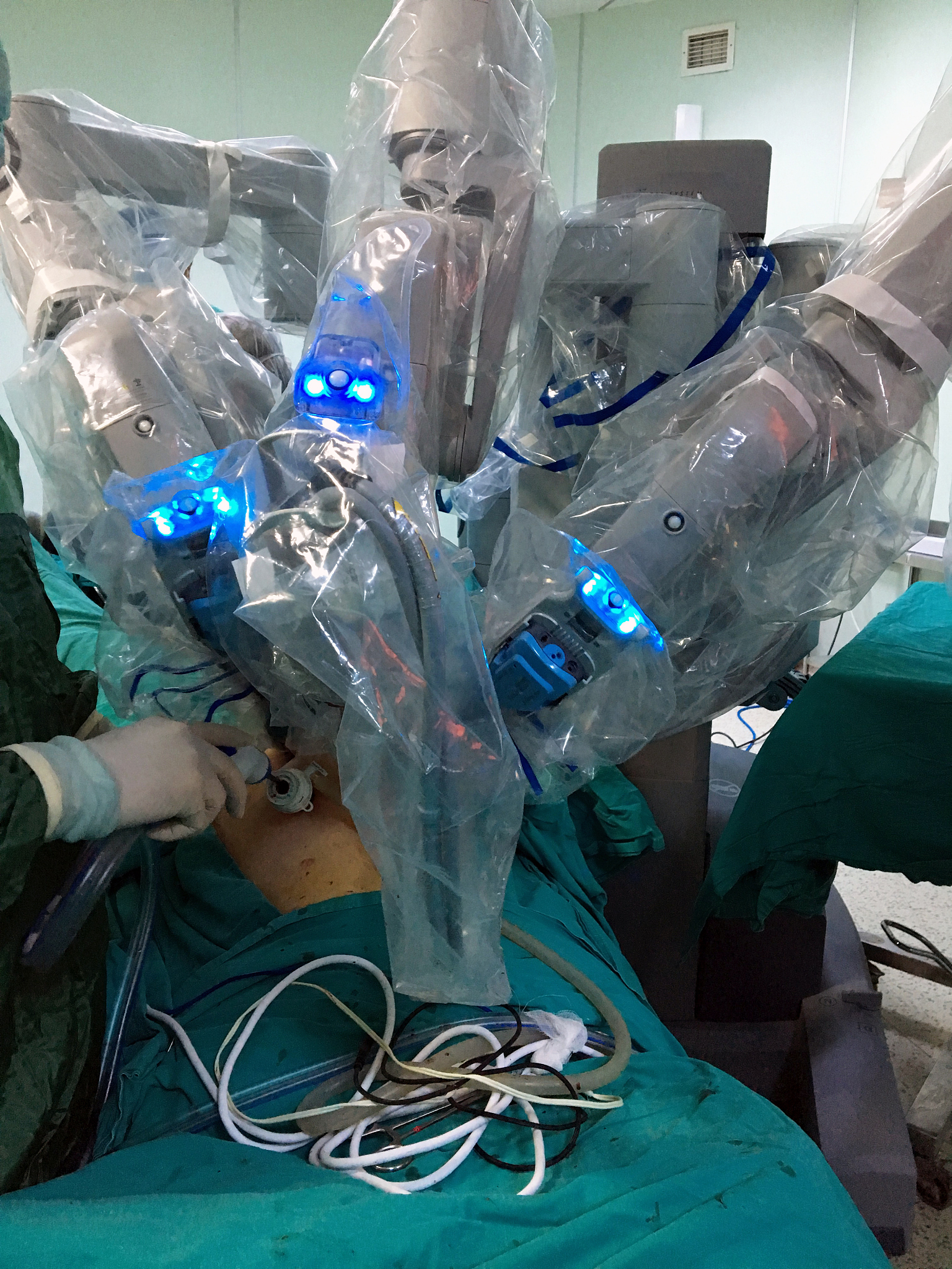 增强现实技术在微创脊柱手术中的应用：提高手术精度和减少辐射暴露