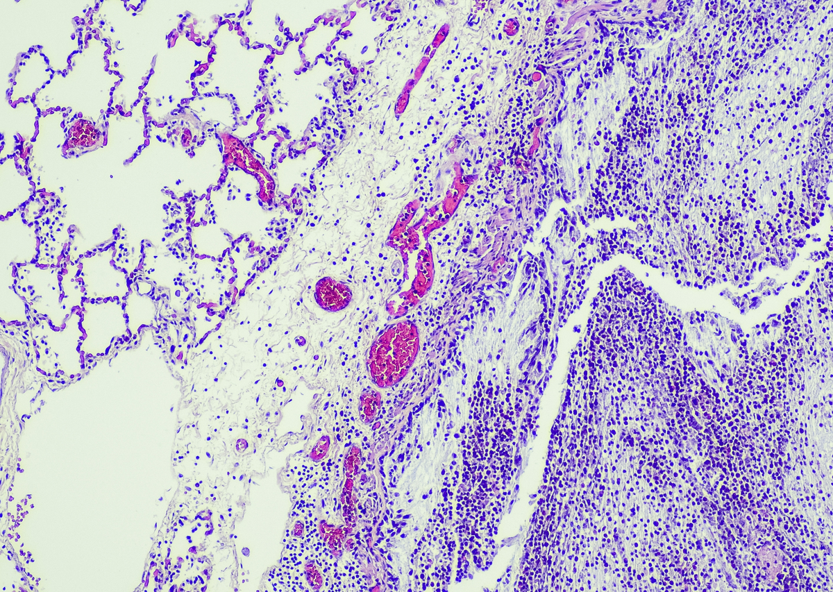 DLD1 和 SW480 细胞系 KRAS 基因突变分析