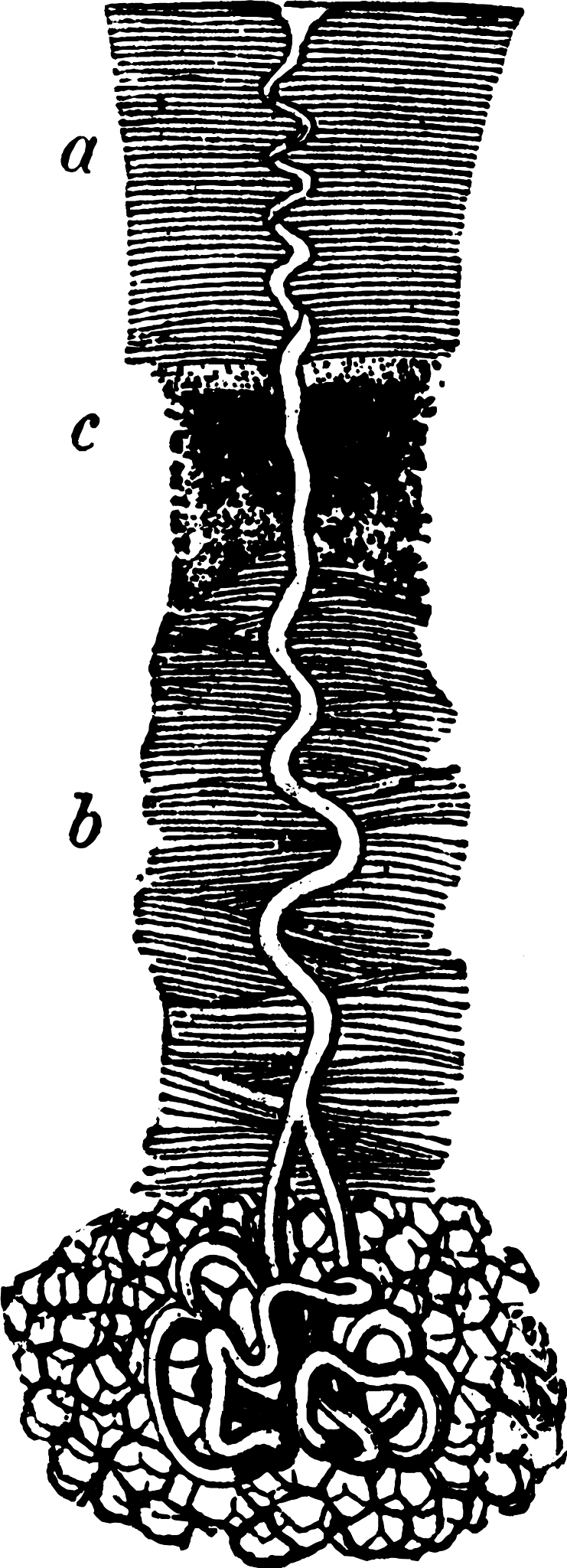 脚臭是什么原因导致的