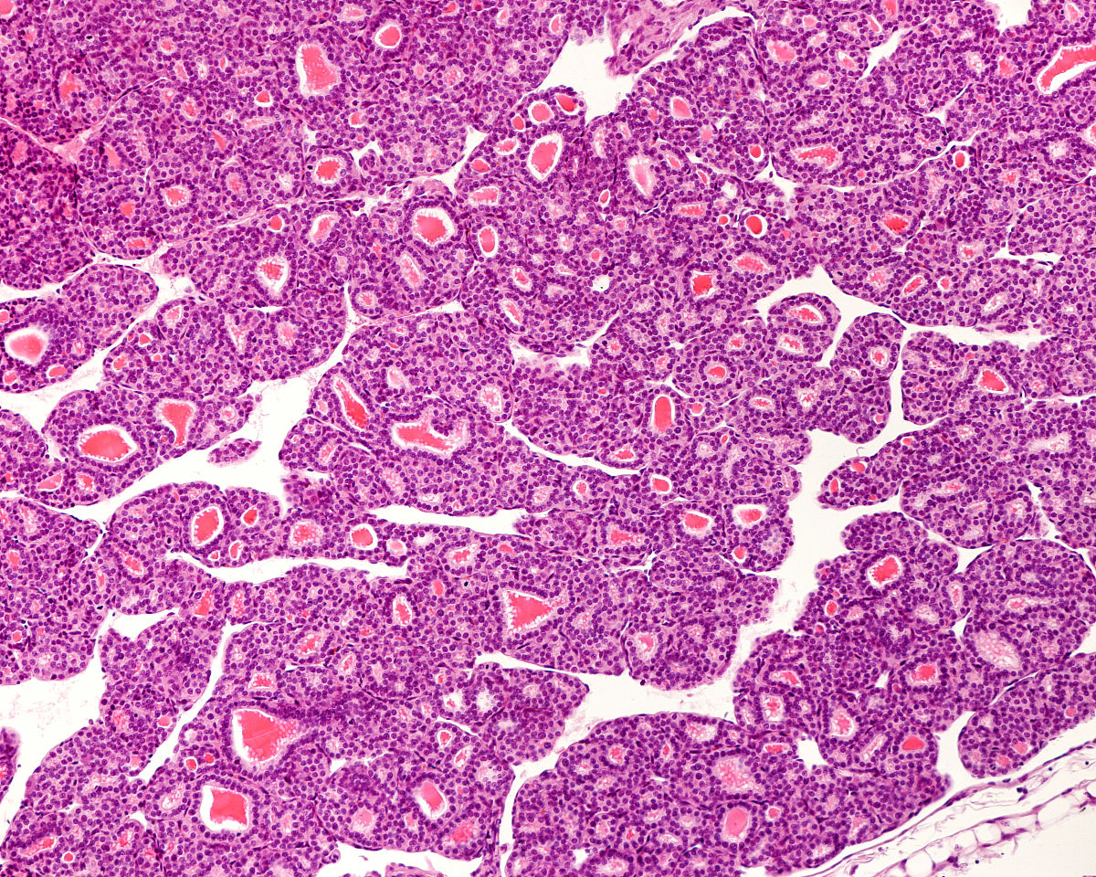 下视丘 松果体 脑垂体 杏仁核 区别？