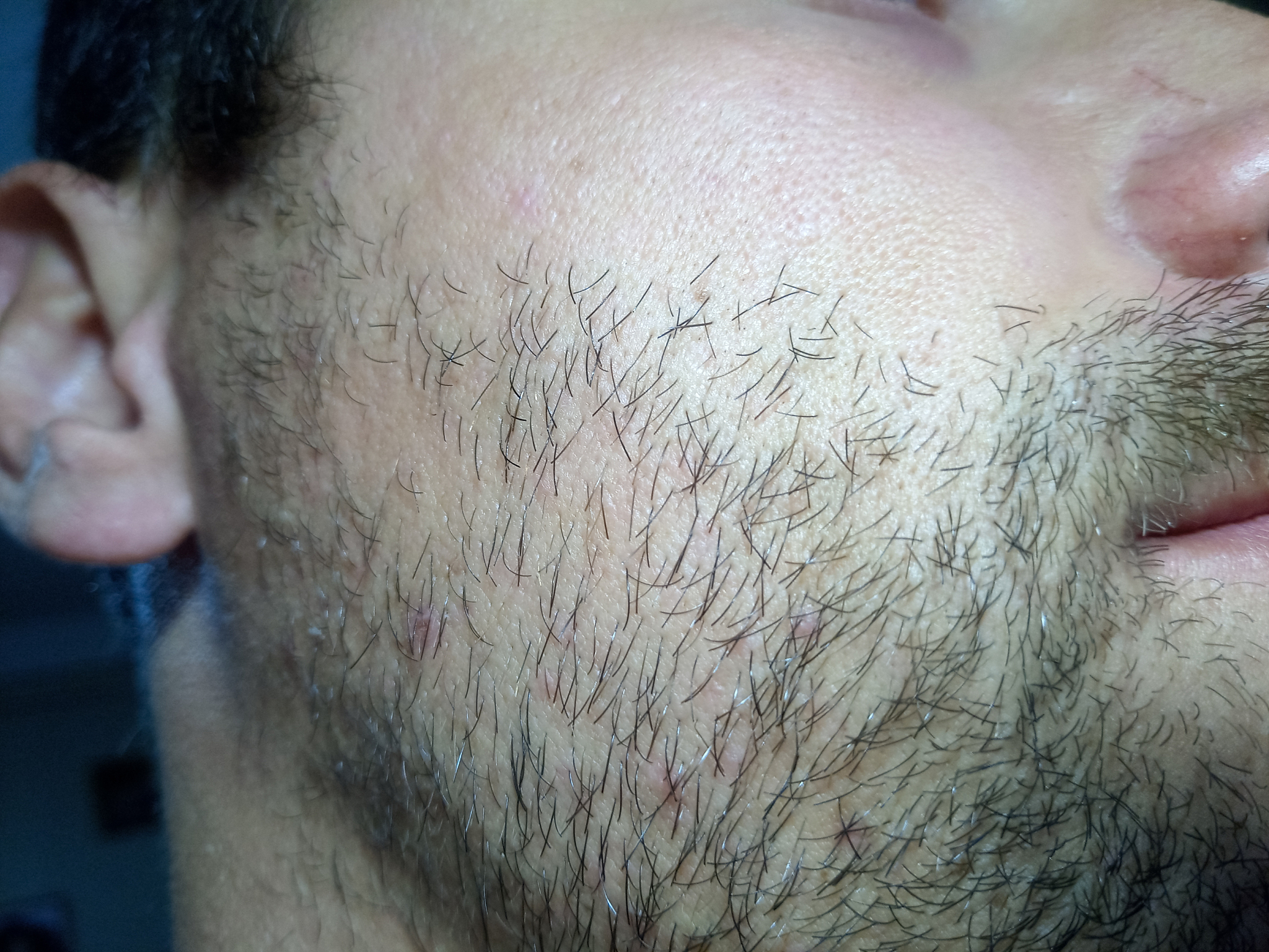 bearded young man, stubble near. unshaven more than a week.