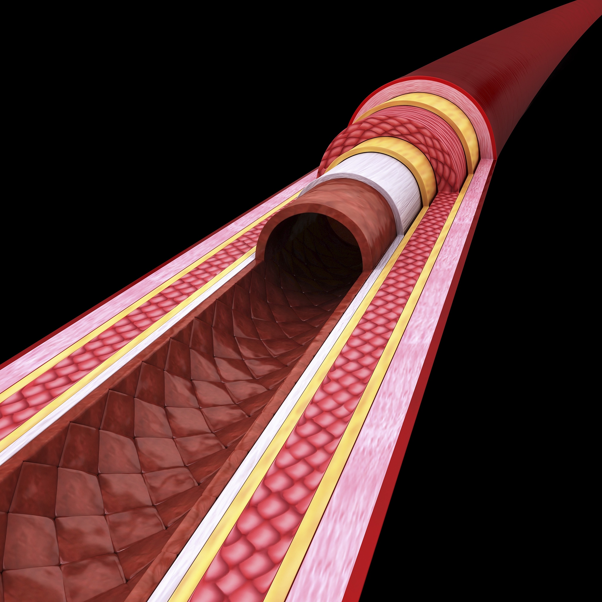 动静脉内瘘狭窄不用愁！PTA术后内瘘护理指南