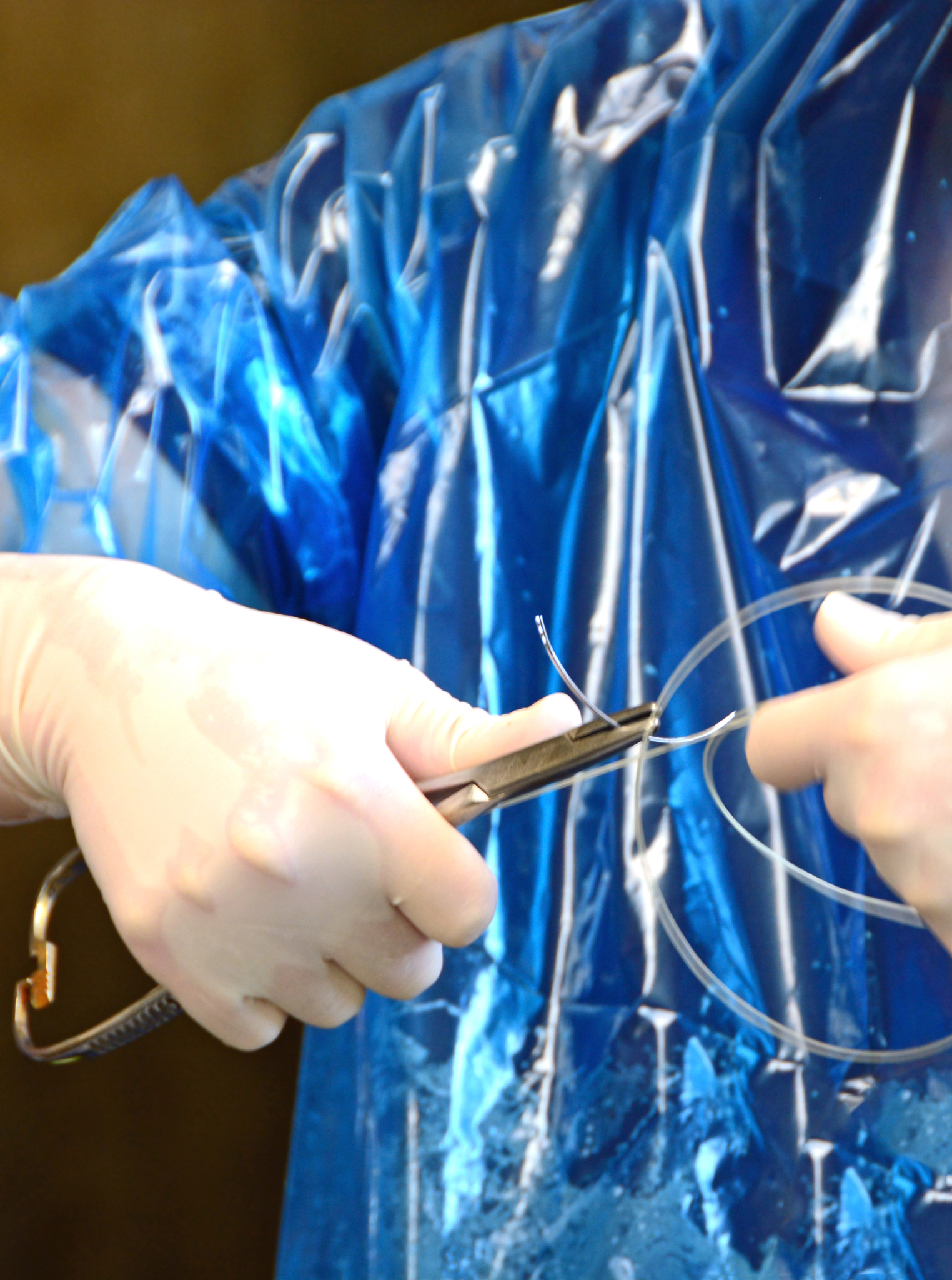 帮我写一份手术创面封闭生物胶的技术痛点800字