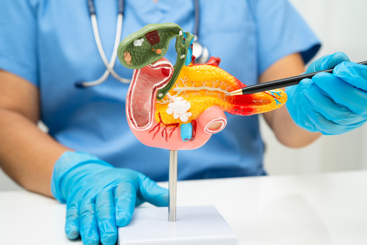 肝门部胆管成型