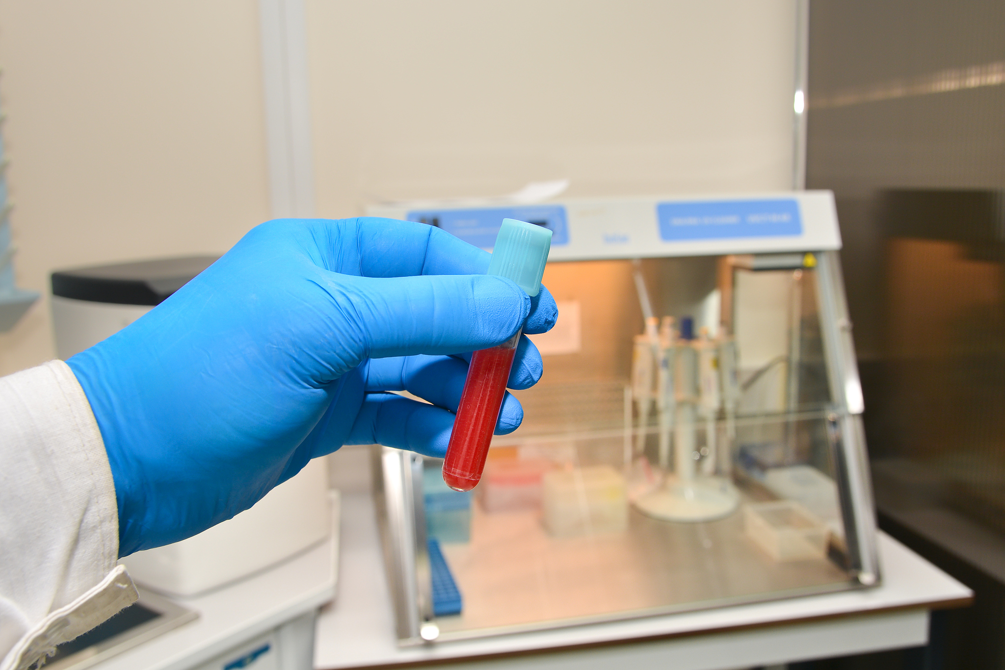 CLINICA CHIMICA ACTA期刊研究范围详细介绍