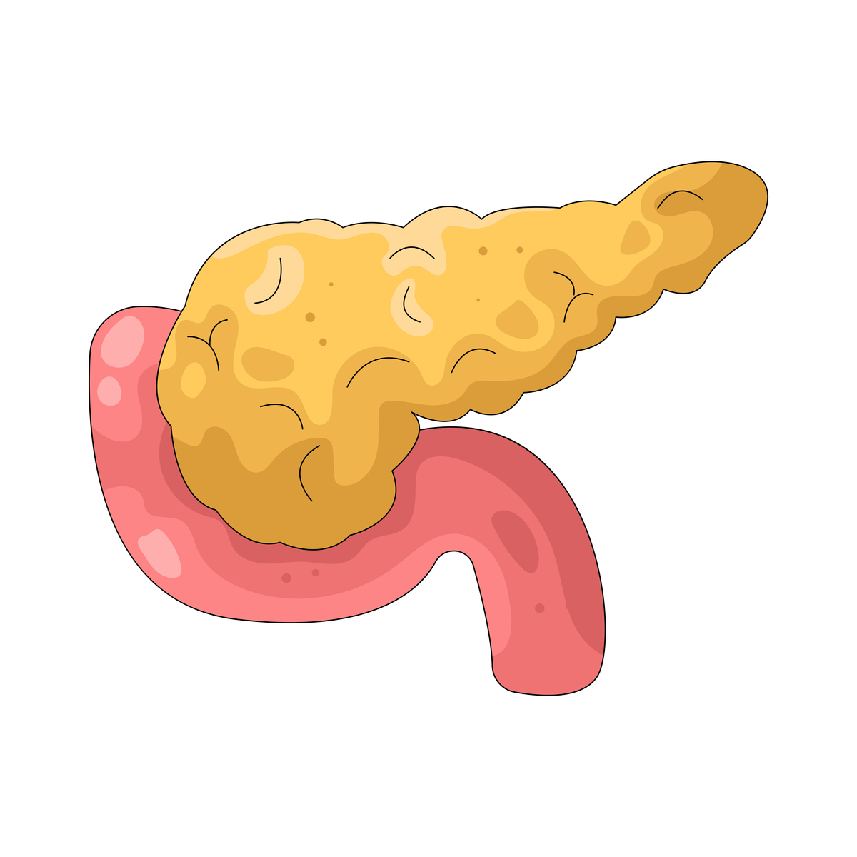 只吃肉会便秘吗？如何预防肉食带来的消化问题？