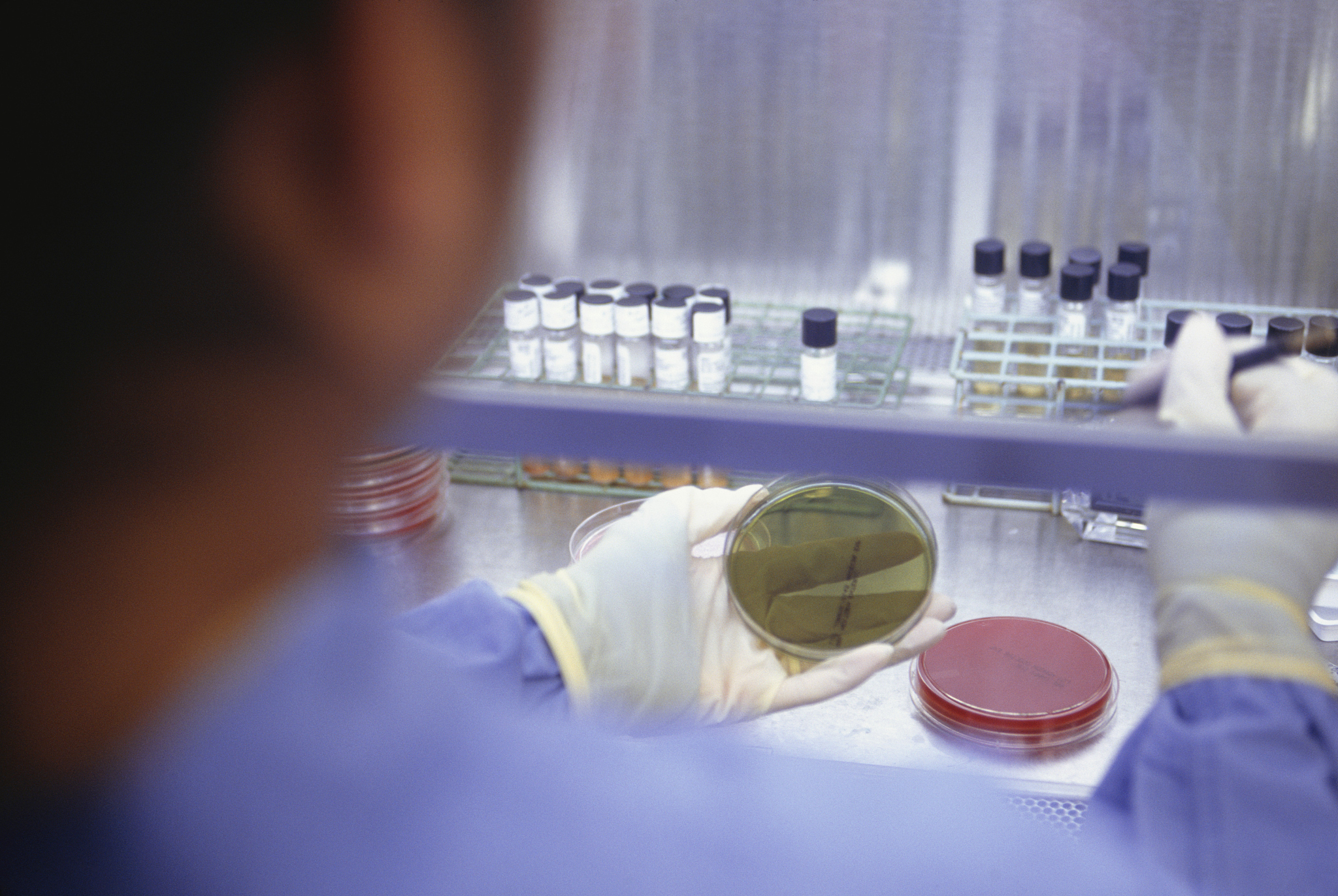 渐冻症可以治疗吗？