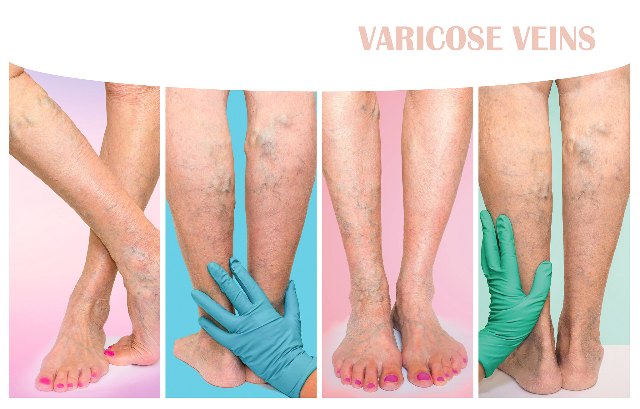 大腿脂肪吸脂，朋友圈爆款文案，塑造完美曲线，快速燃脂，告别粗壮！