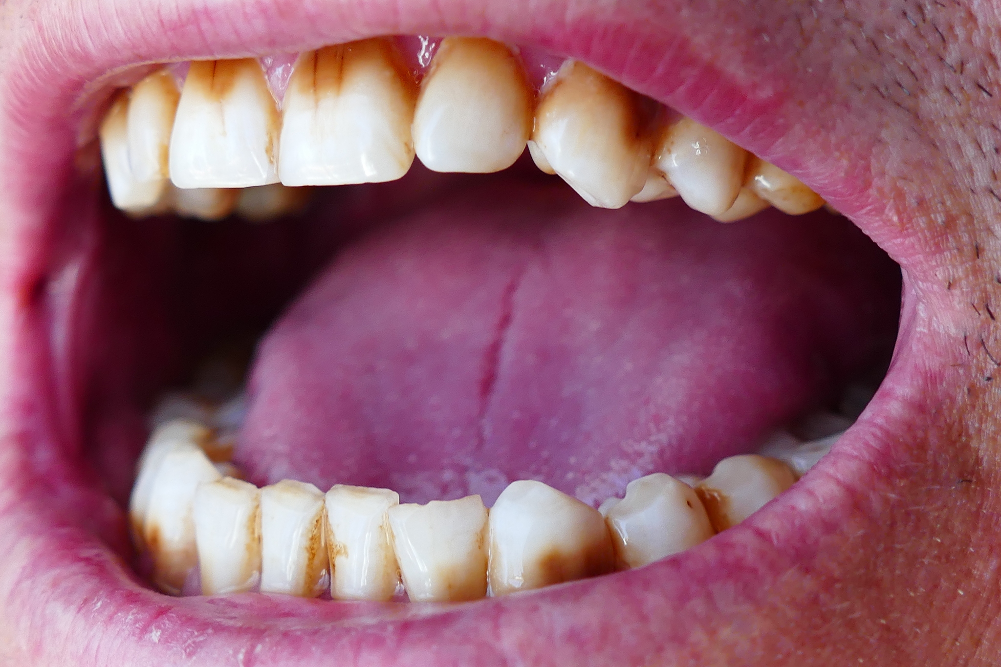 大同第二卫生学校口腔修复工艺专业怎么样？值得报考吗？