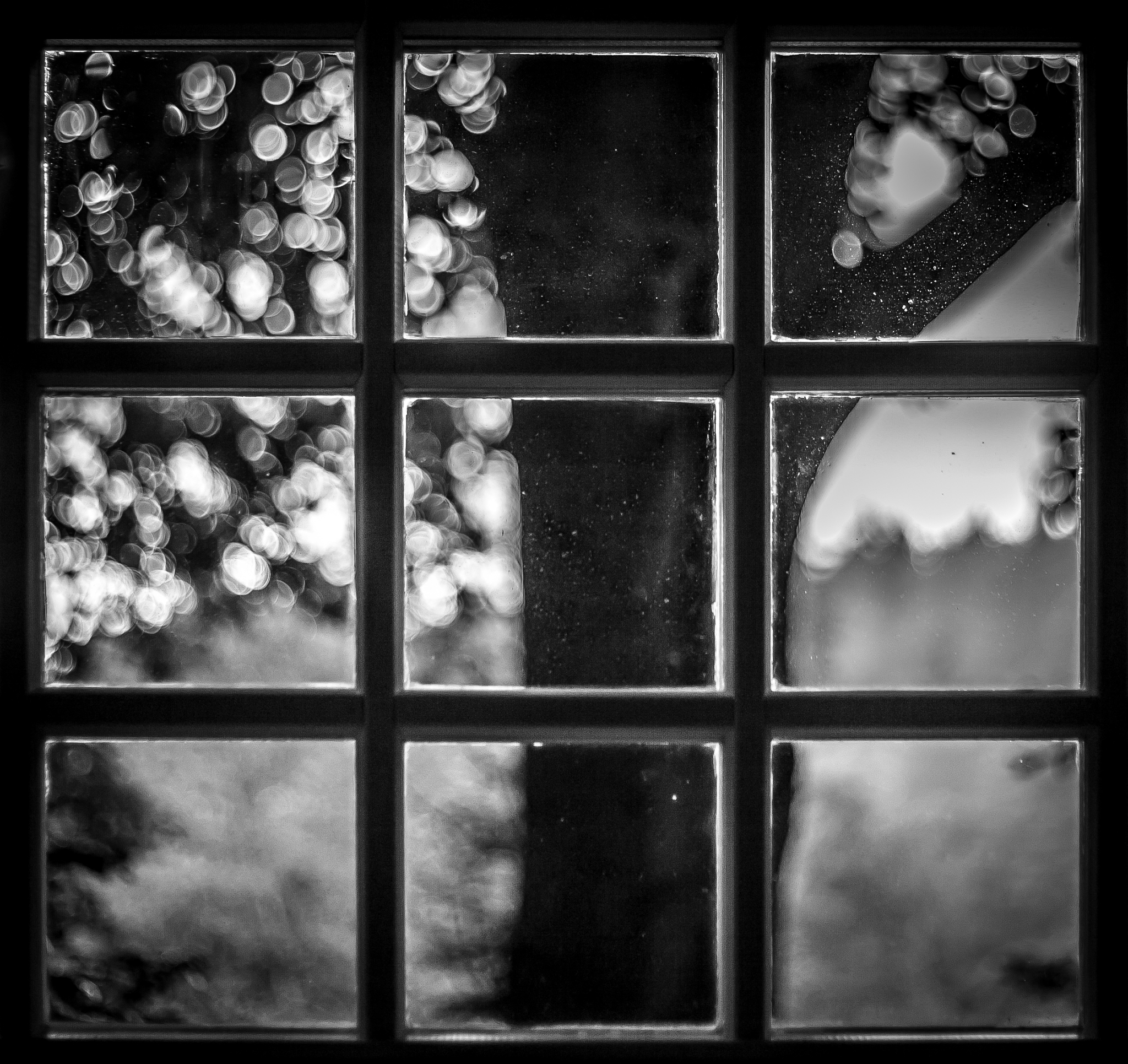 润色：Digital Subtraction Angiography DSA is the gold standard for diagnosing carotid artery disease However as an invasive examination DSA involves radiation and is relatively expensive Moreover it cann