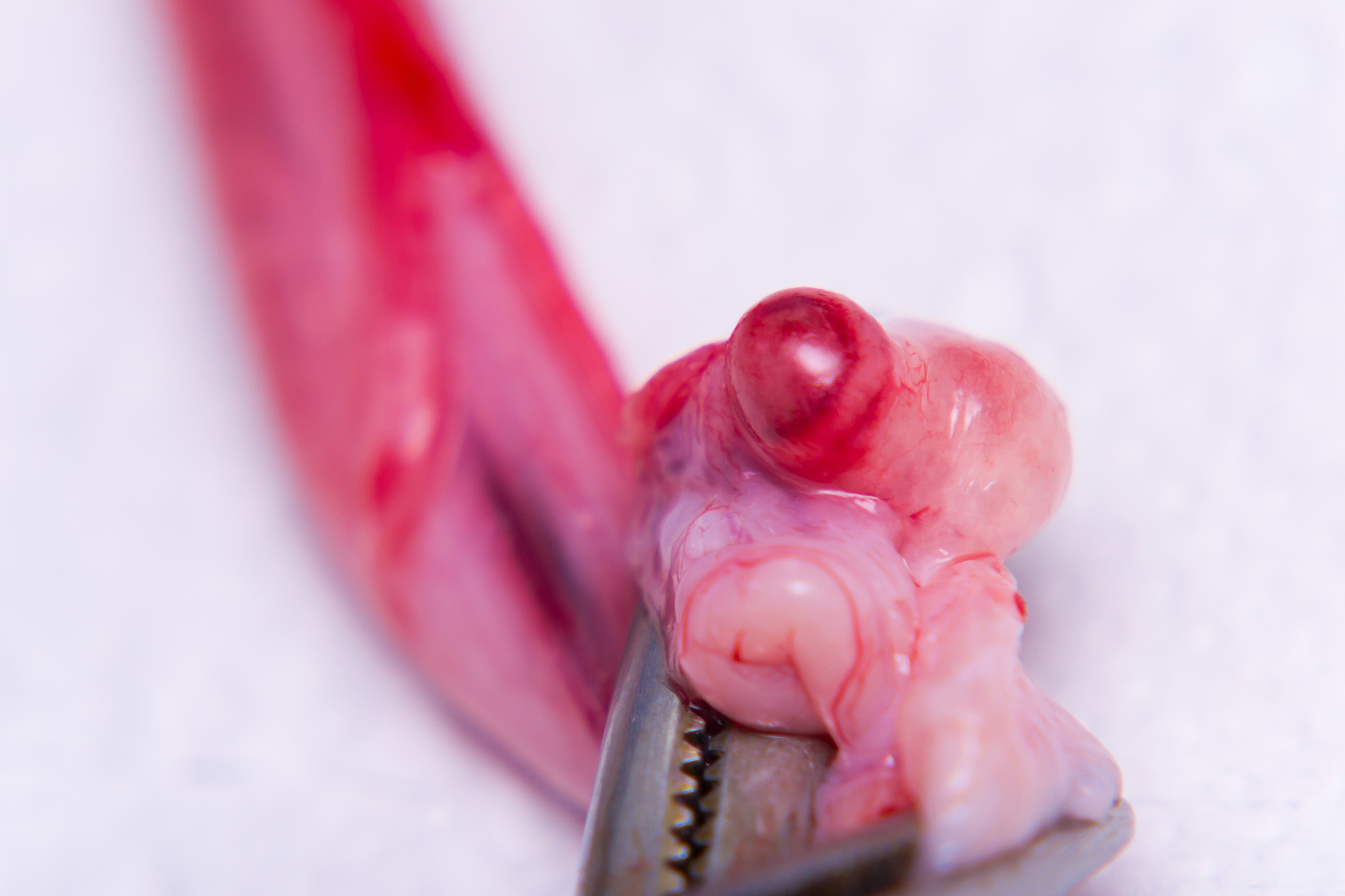 如何介绍促黄体生成素