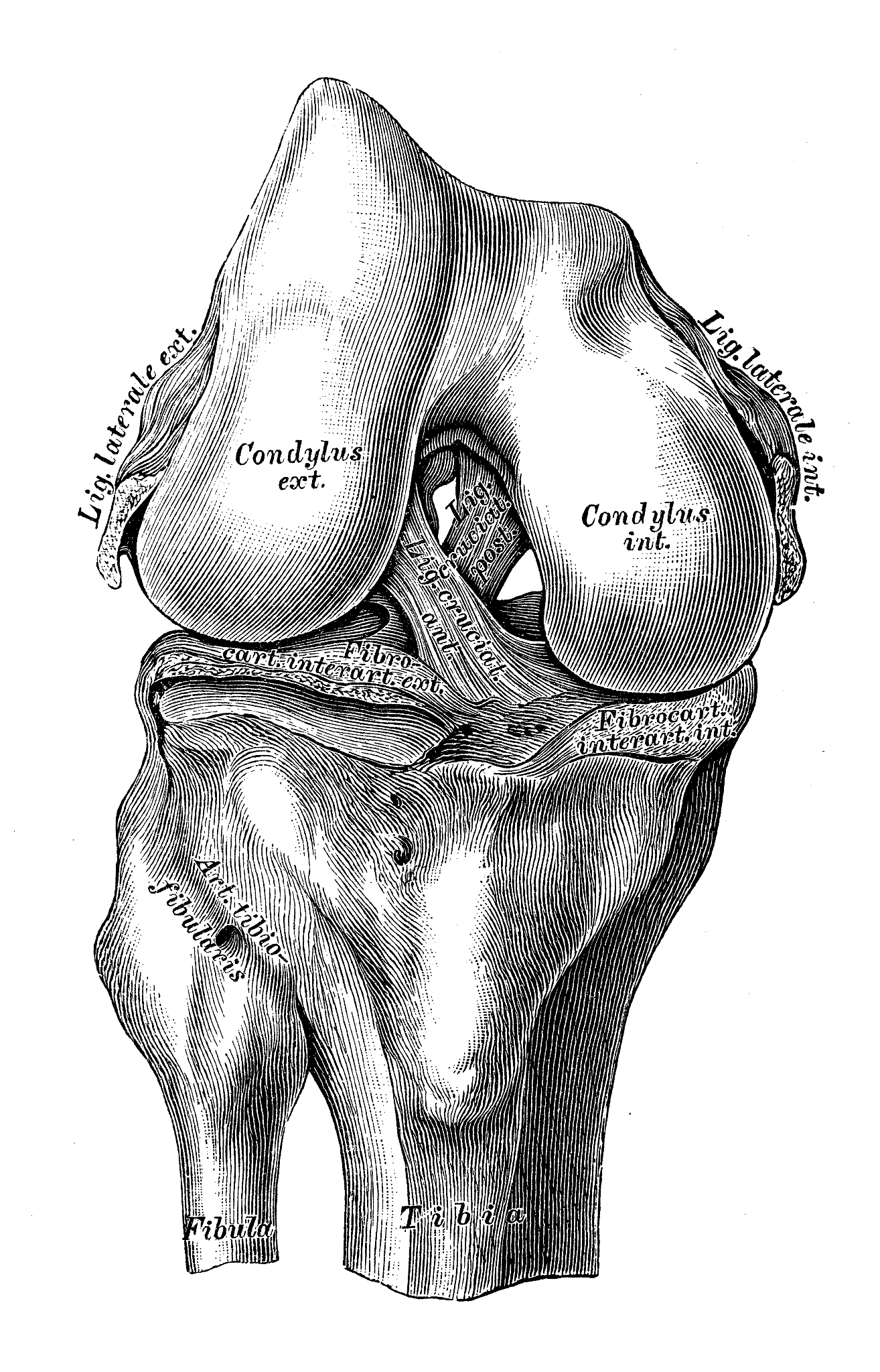 这种手术适应症相对较窄？术前术中评估韧带损伤很重要！