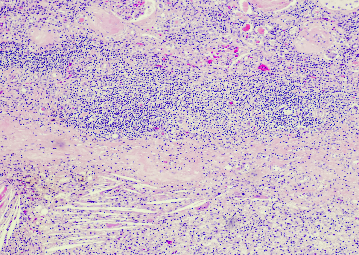 Isolation of Primary Human Endometrial Epithelial and Stromal Cells: A Modified Protocol