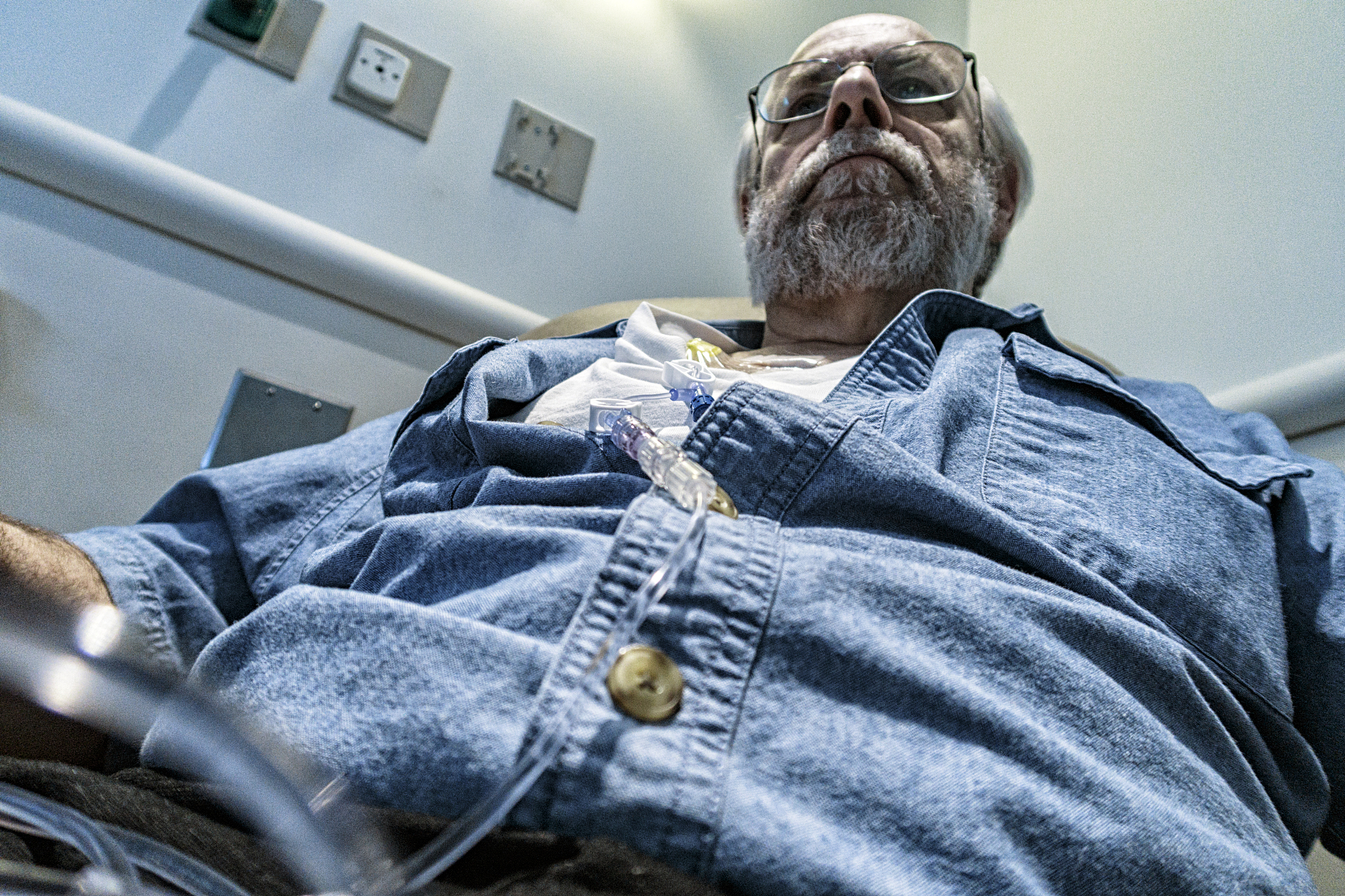 老年脑胶质瘤治疗方案：手术、放疗、化疗及护理