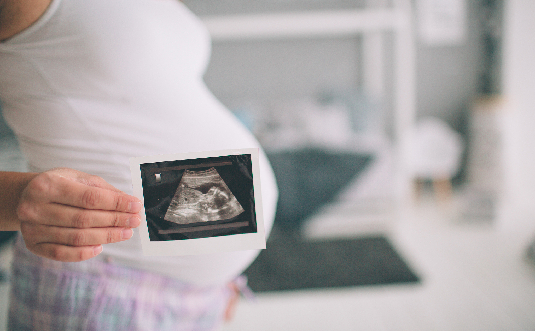 pregnant woman holding ultrasound scan. concept of pregnancy hea