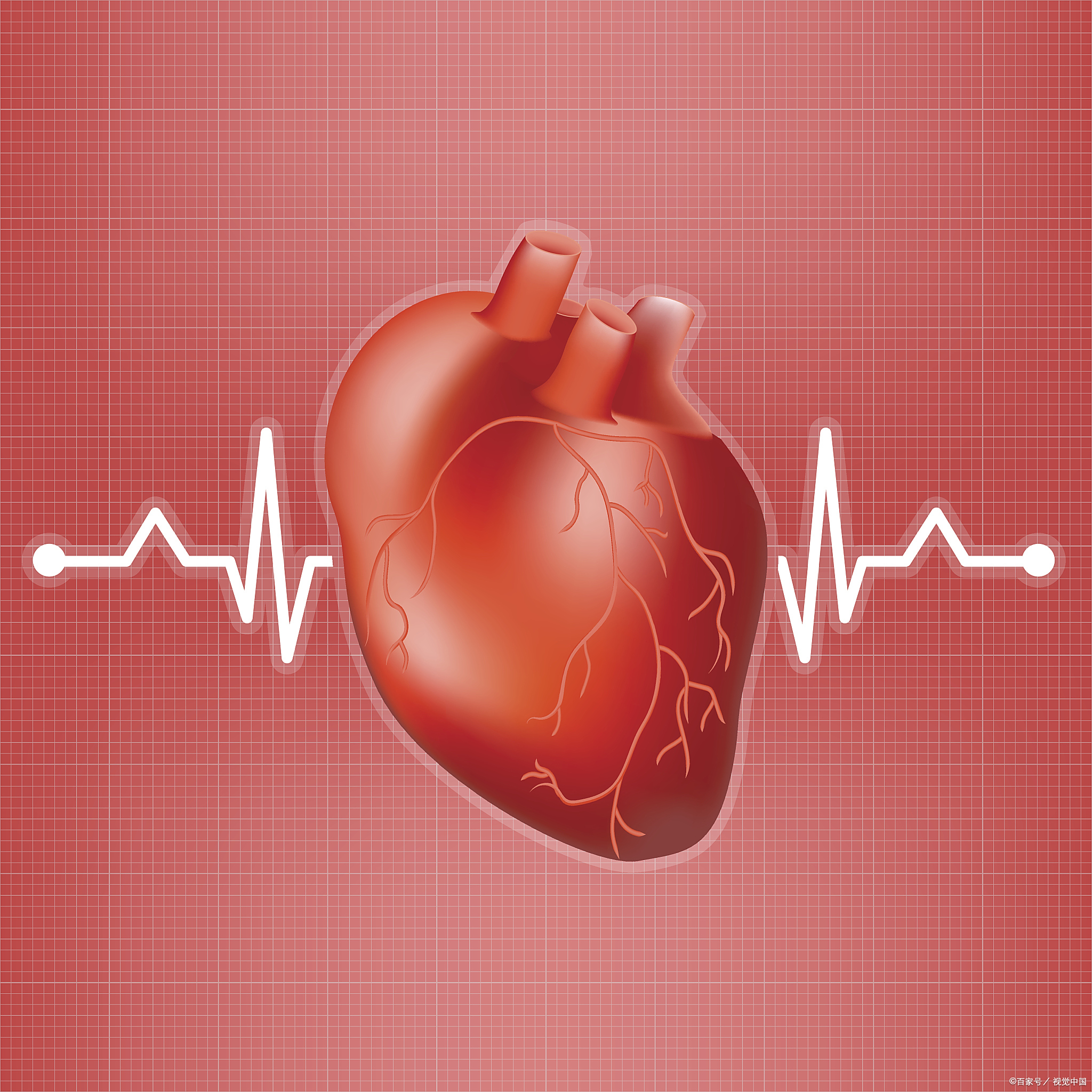 肥厚性心肌病患者为什么需要控制心率？