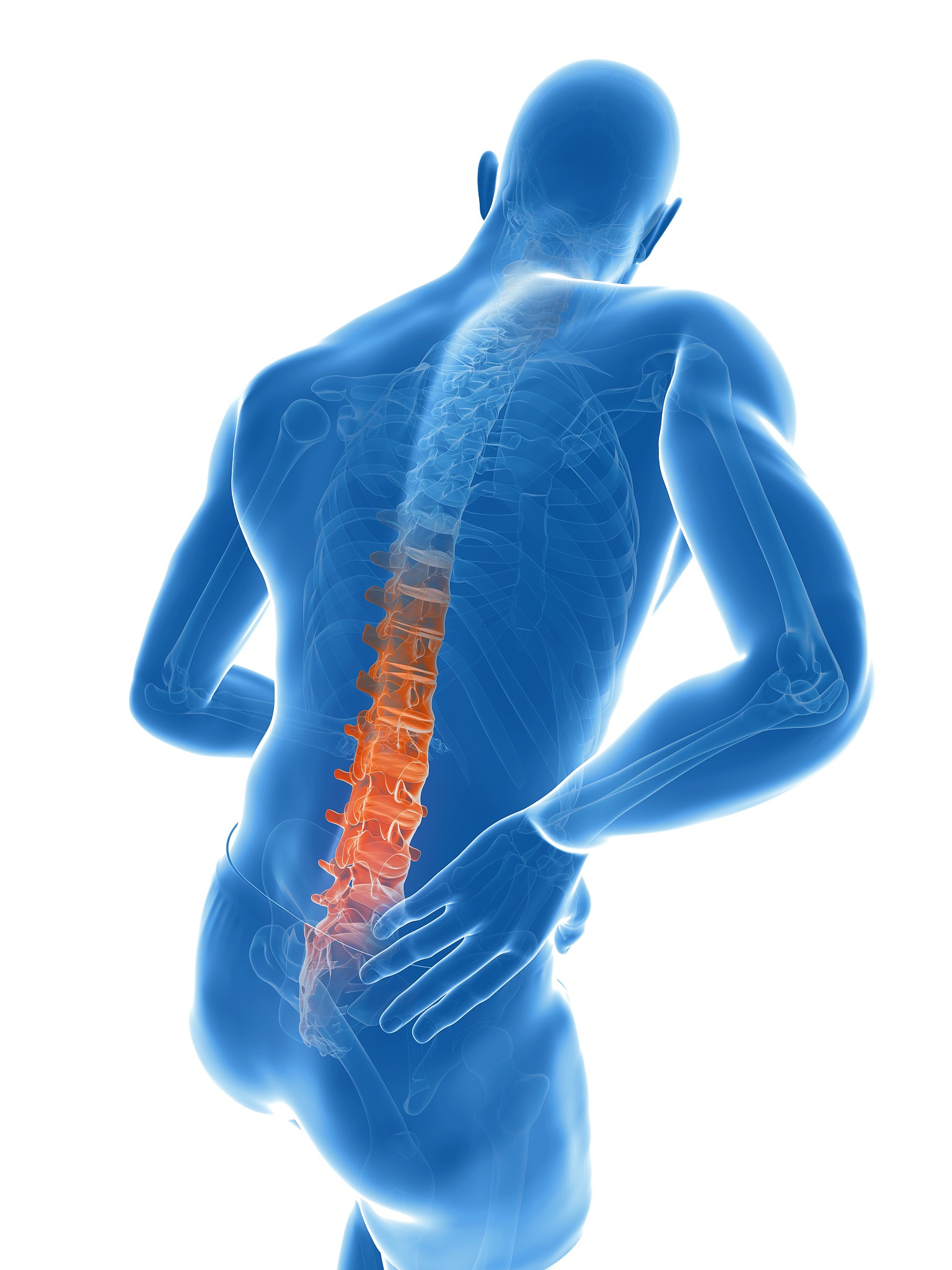 back pain, artwork