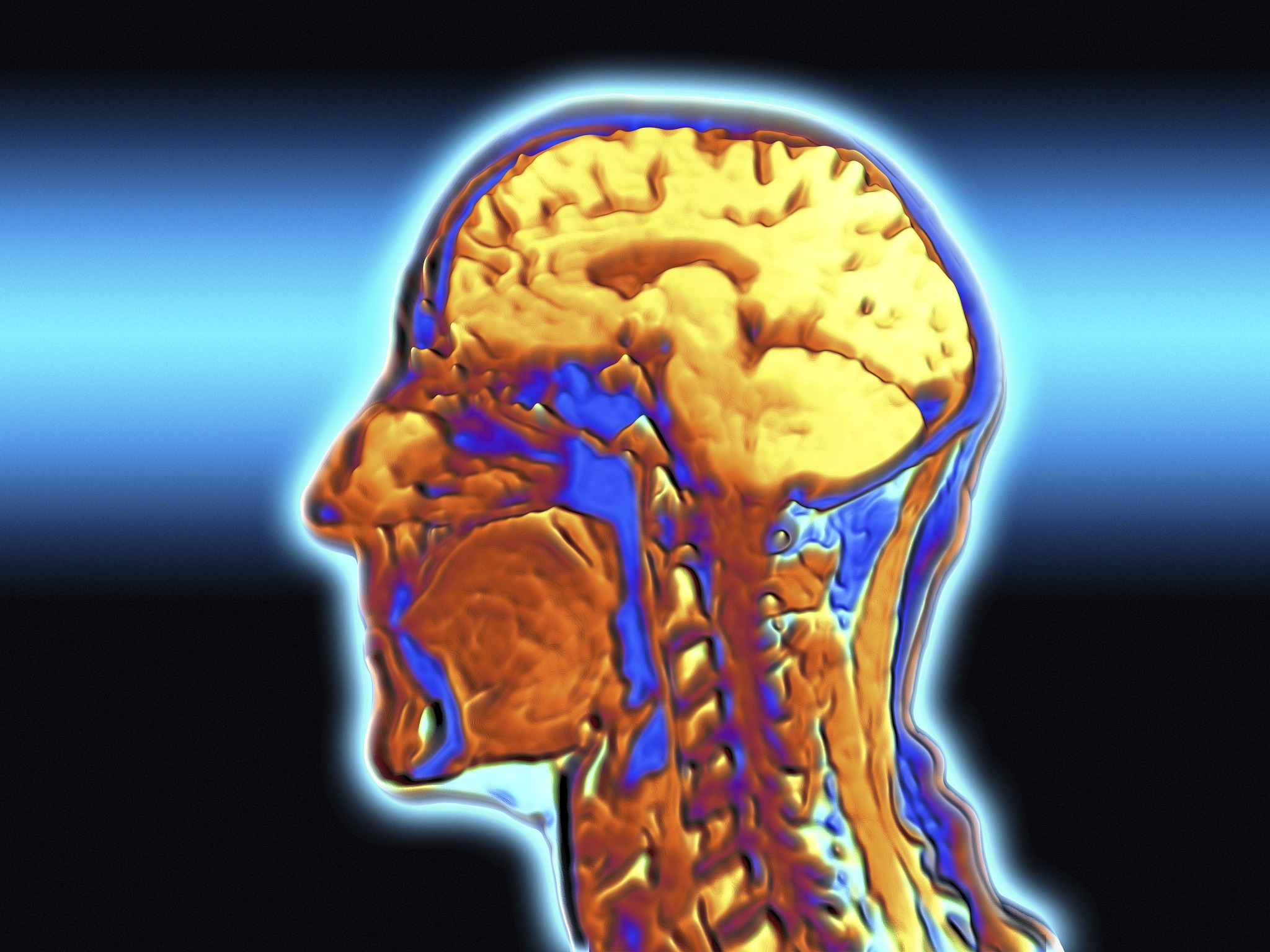 中重型颅脑损伤：症状、治疗和康复