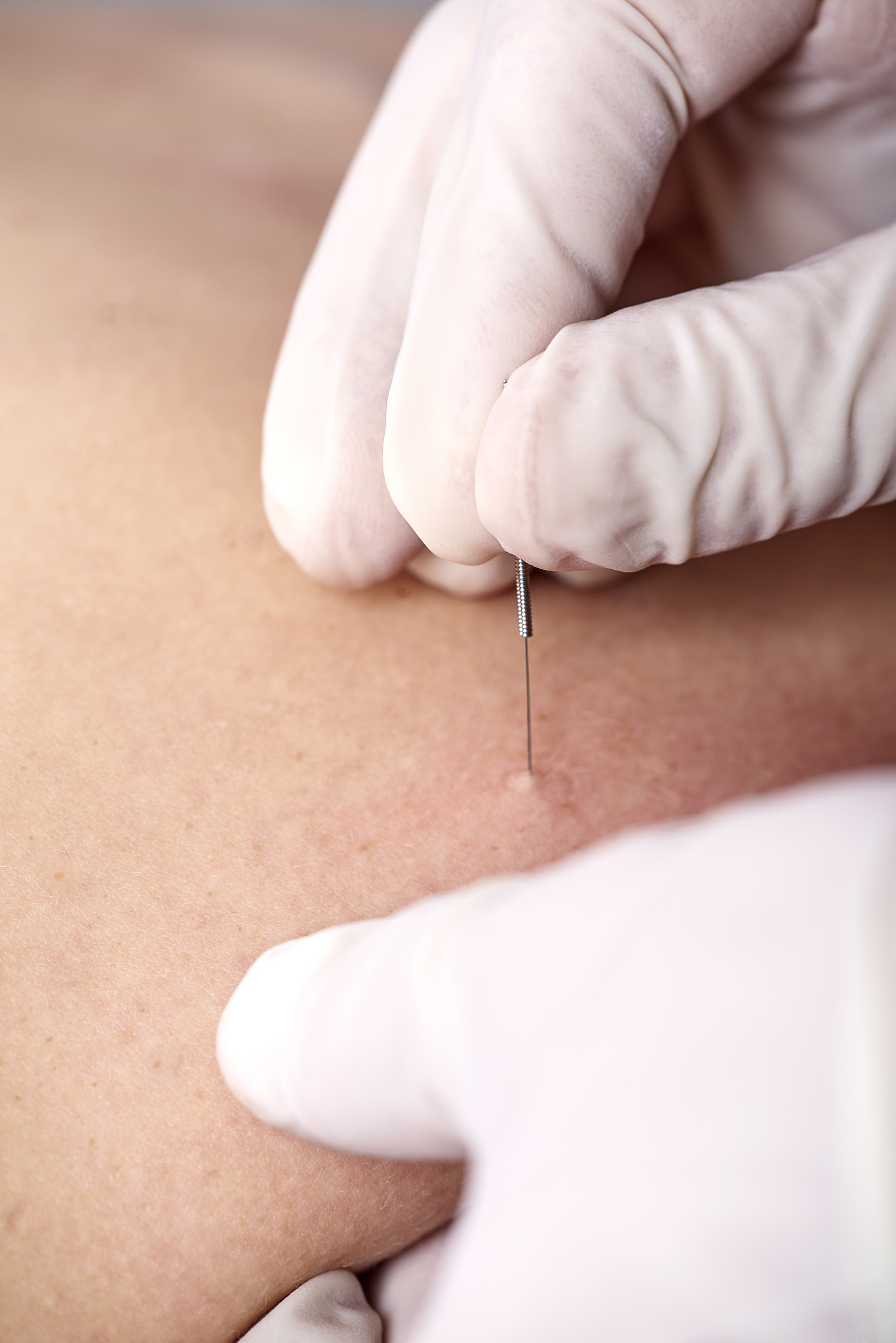 门冬胰岛素笔注射：正确角度指南