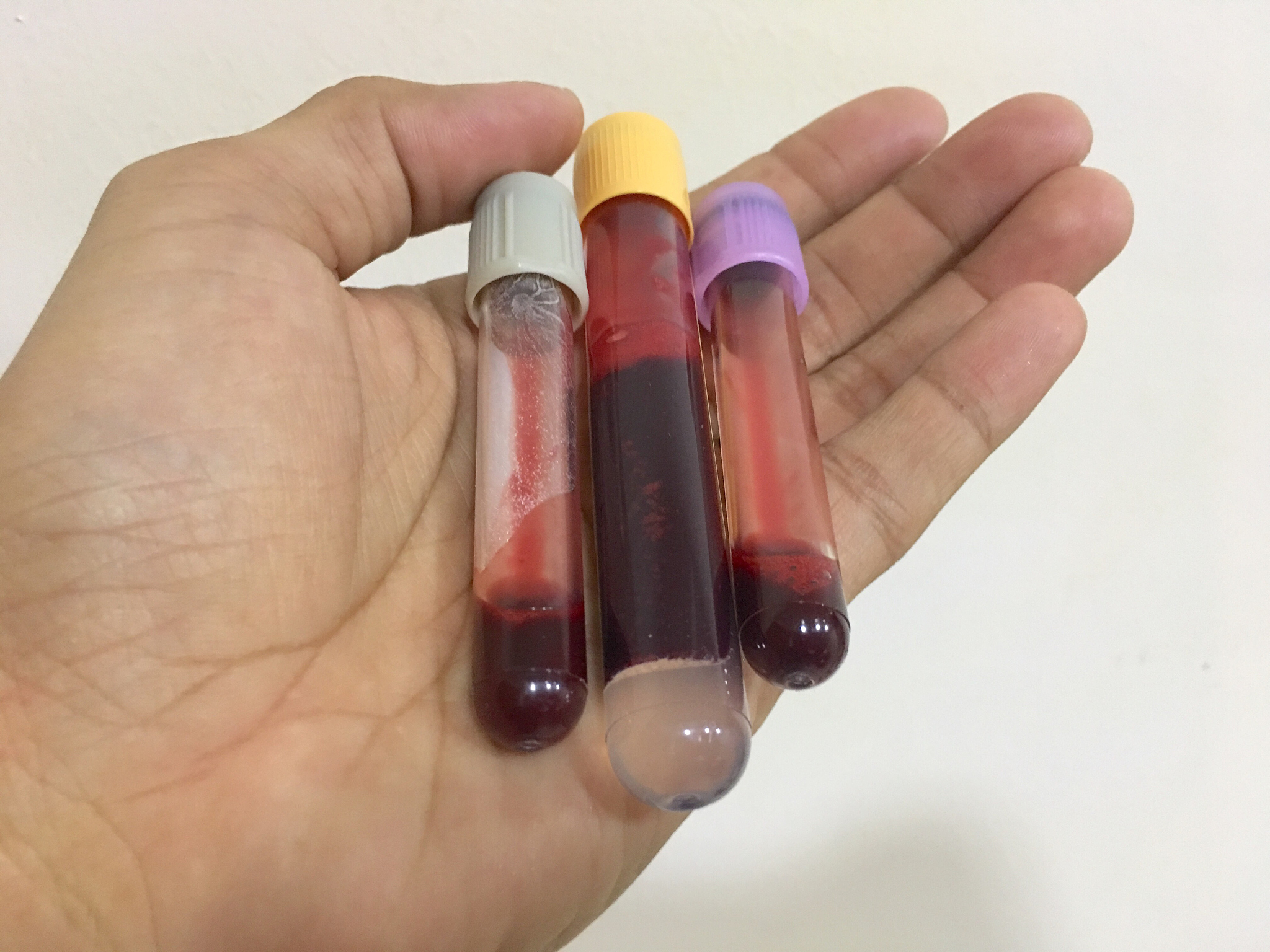 医学知识问答：解答您的健康疑惑