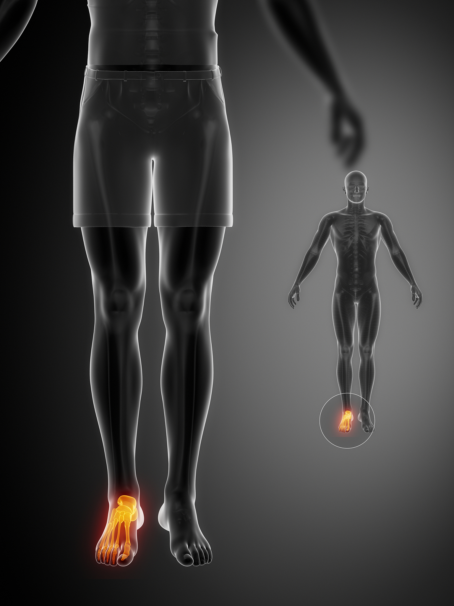 踝关节扭伤：症状、原因、治疗与关节镜手术