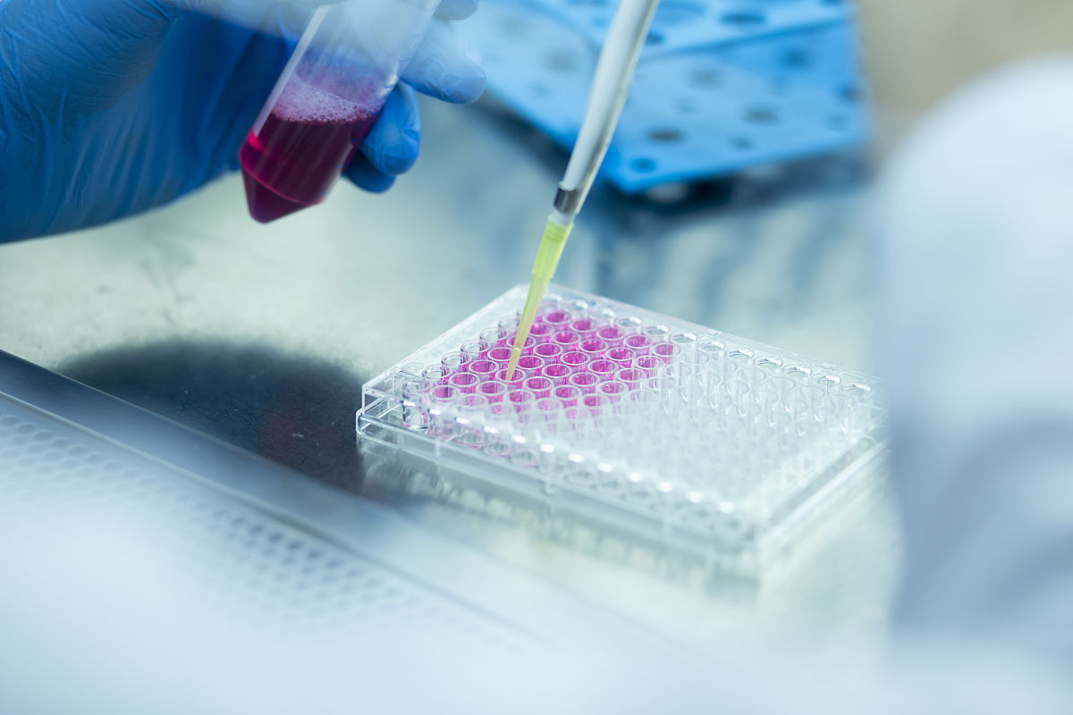 结直肠癌早筛芯片：快速准确，有效预防