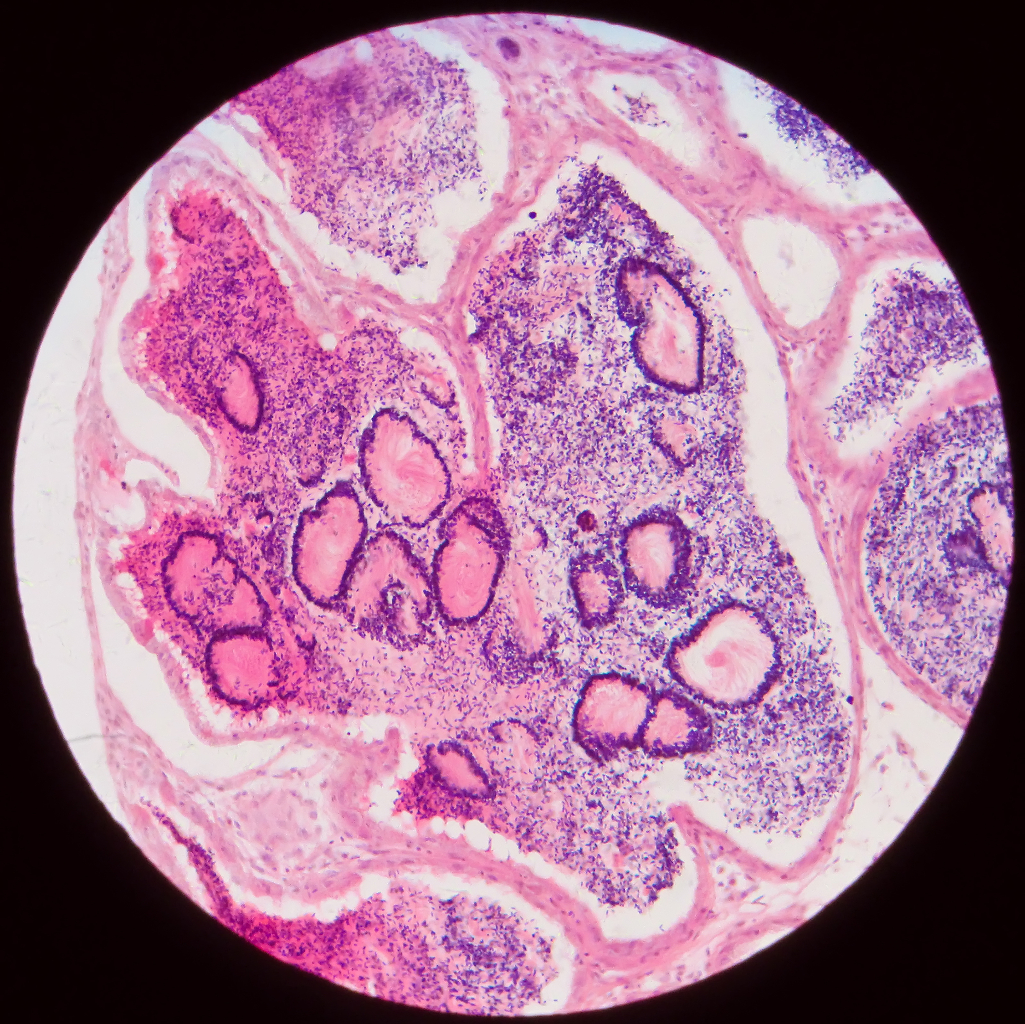 乳腺癌病理切片数据集：助力早期诊断和治疗