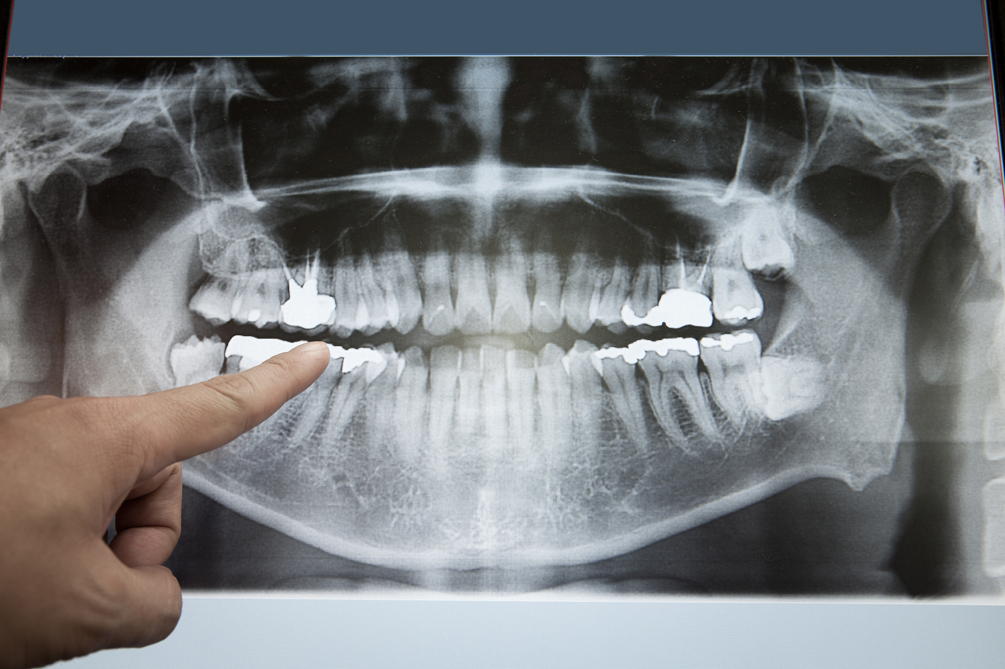 海宁卫生学校2021年招生简章