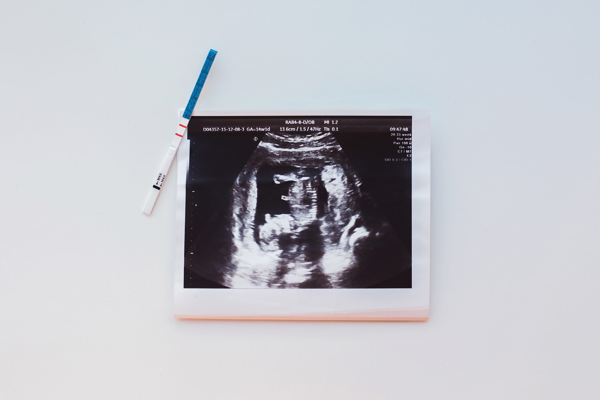 超声大平底调整灵敏度求缺陷当量