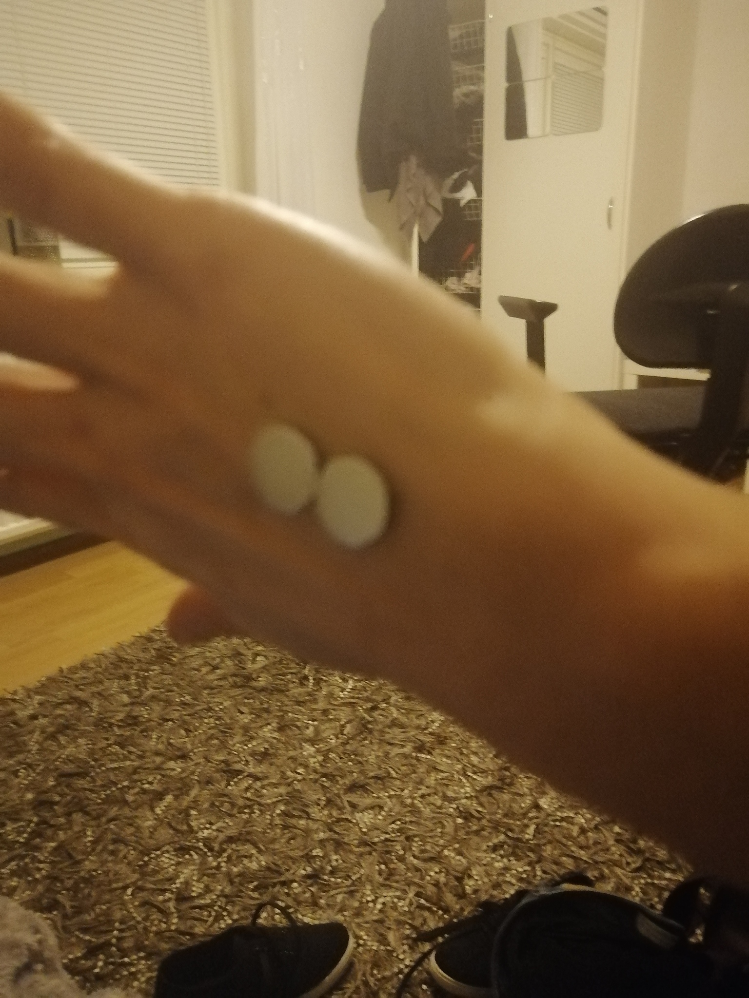 腋下、脚脖子、富贵包也能吸脂？你可能不知道的吸脂部位