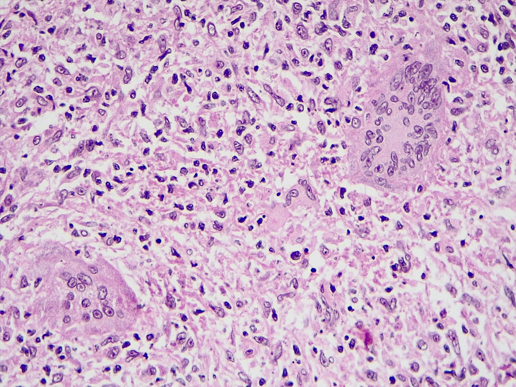 如何用光切显微镜测量表面粗糙度rz的值ra为何不宜测量