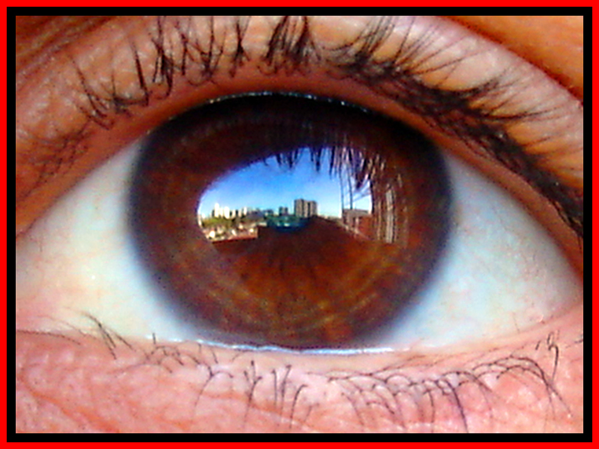 眼睛模糊头痛是什么病