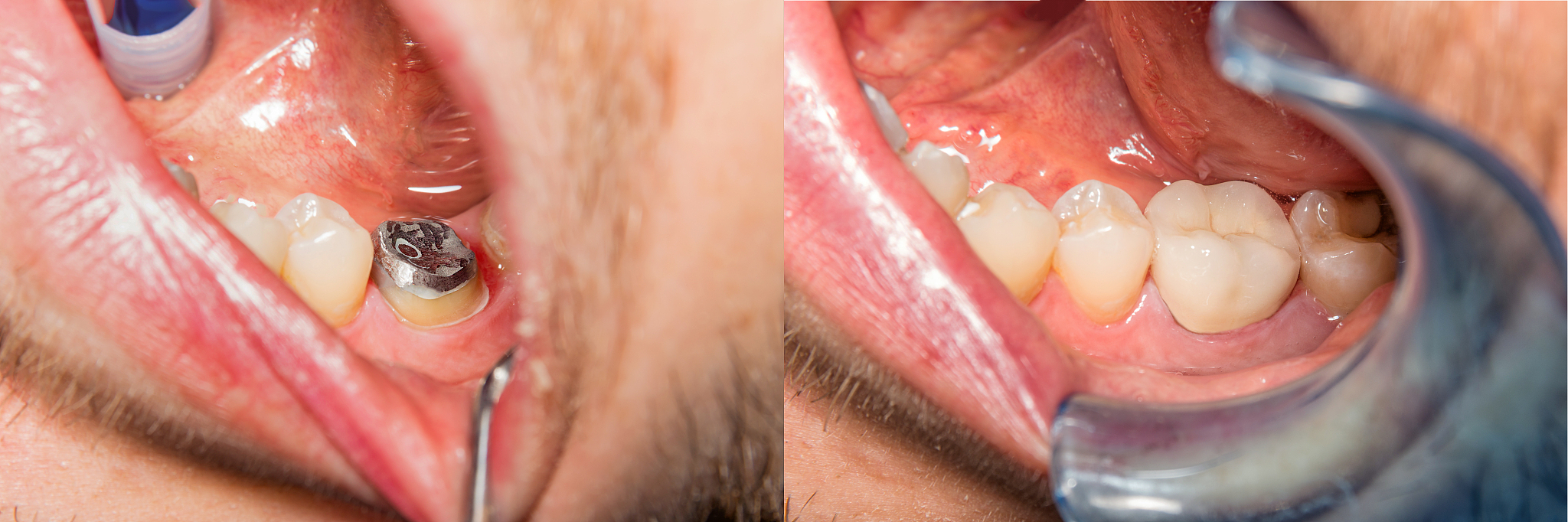 山东济宁卫生学校口腔工艺技术专业怎么样