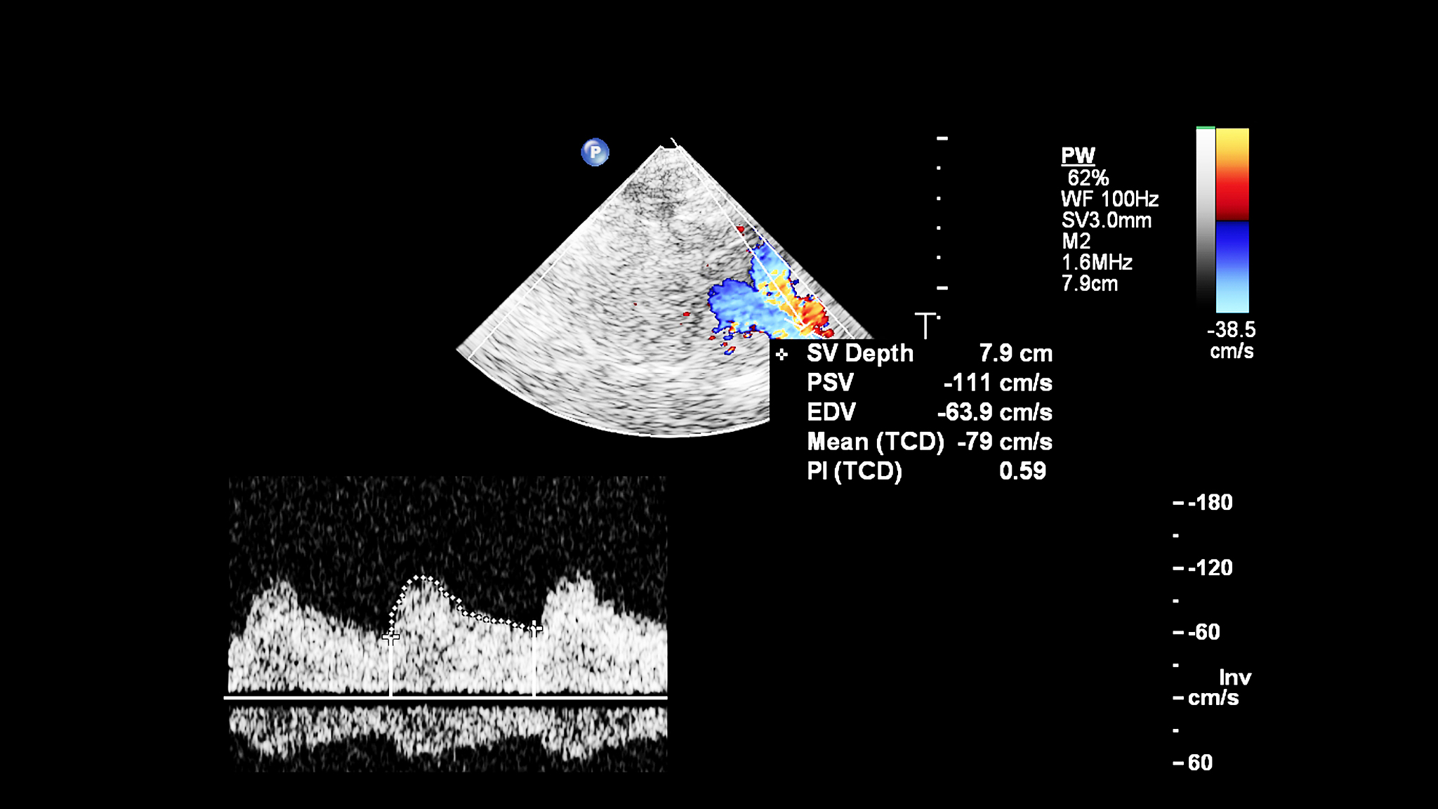 neo-hookean模型中一维状态下应力与拉伸比的公式关系