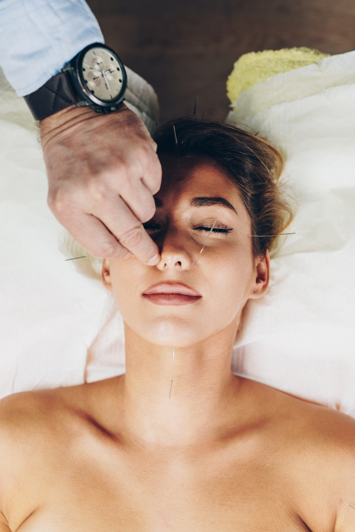 acupuncture and massage treatment