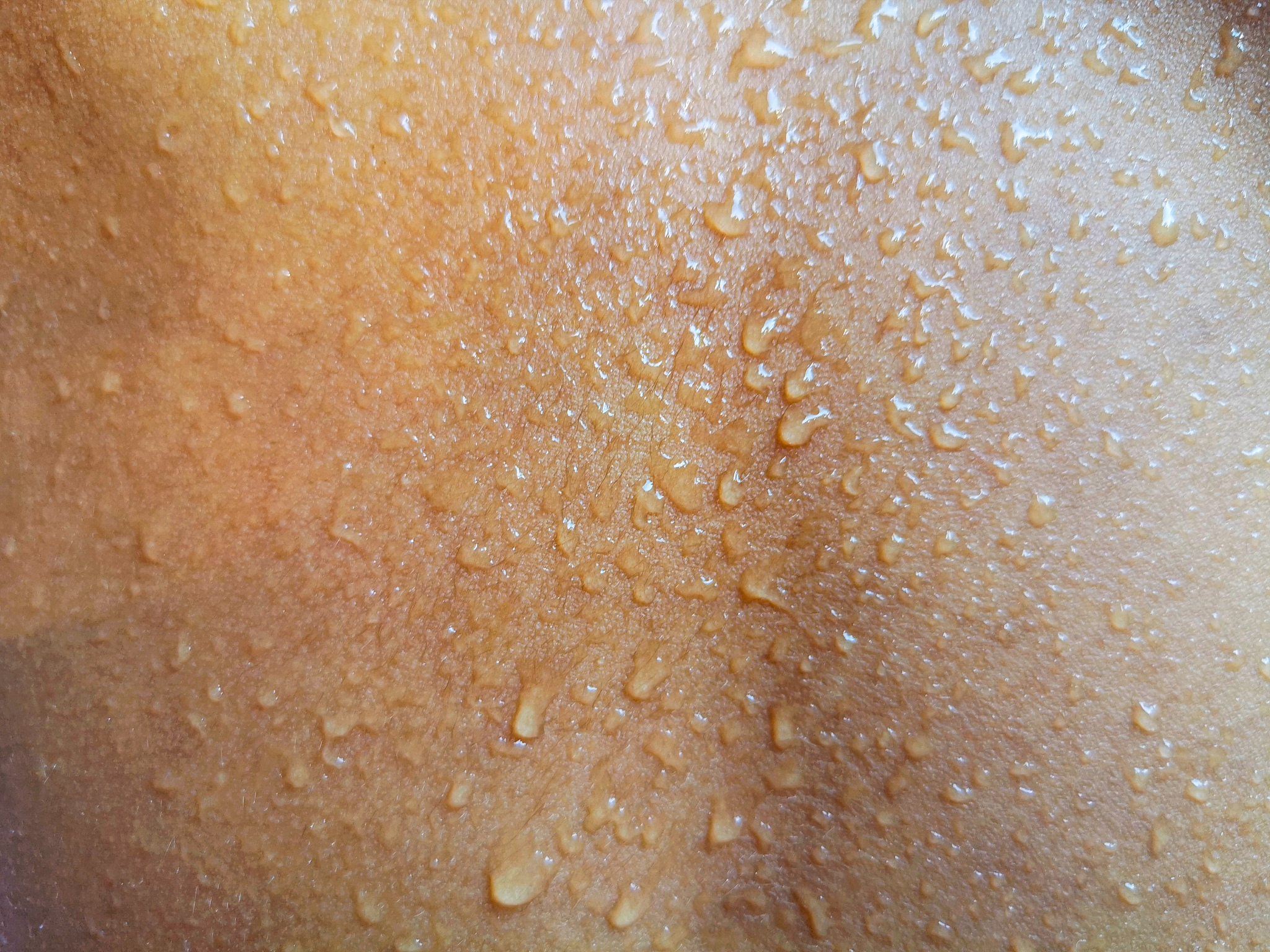 water drops at the skin