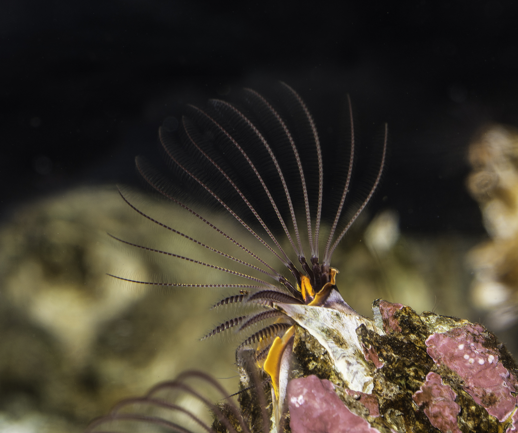龟头红肿疼痛？可能是龟头炎或包皮炎！