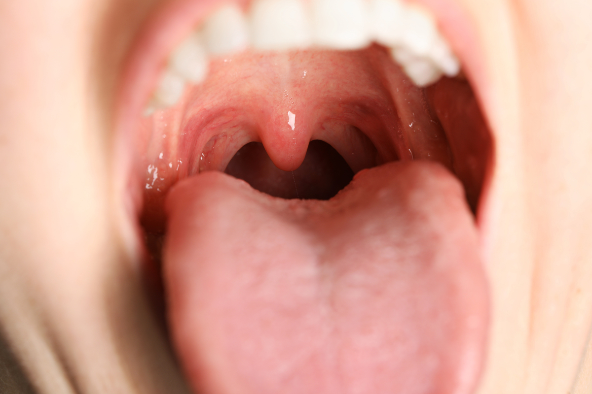 口苦、口酸、口痛…不同口腔症状背后的原因