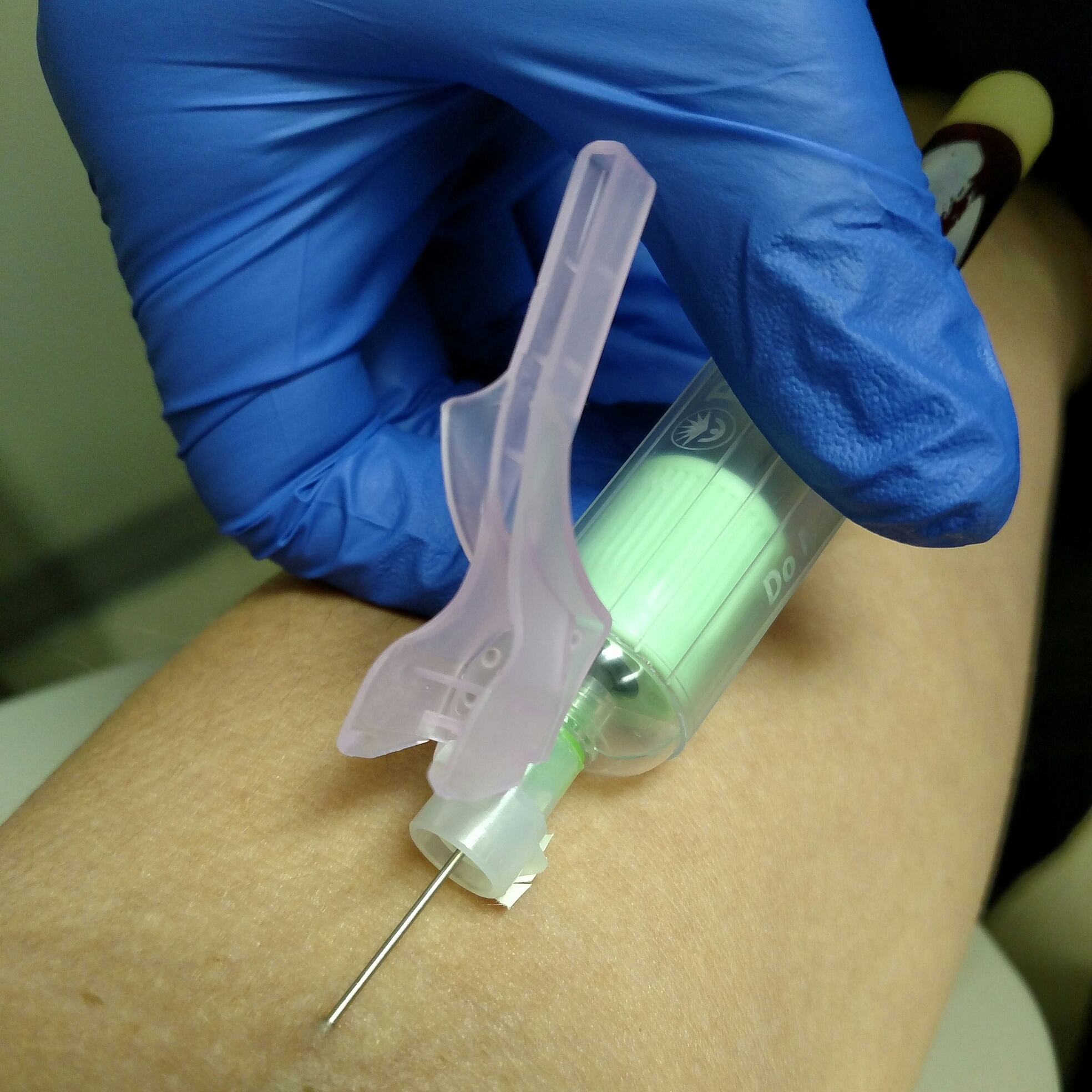 男性尿失禁外科治疗方法：人工括约肌植入及最新技术