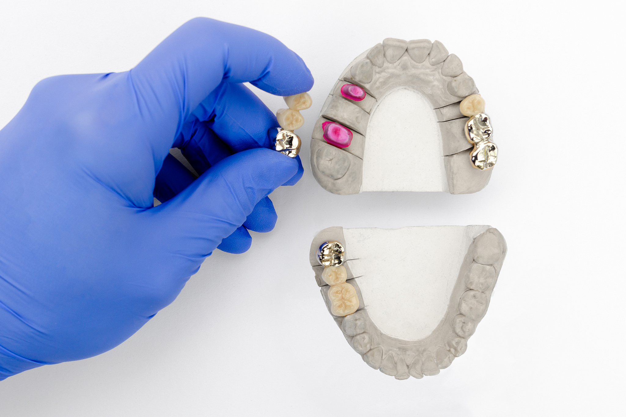 四川大学华西卫生学校口腔修复工艺专业简介 - 培养口腔修复人才的理想选择
