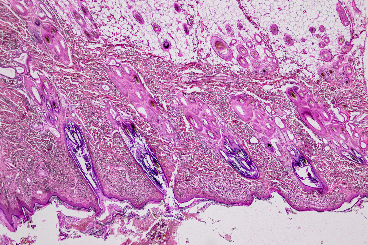 KRAS G12C和G12D突变结直肠癌细胞系：研究与治疗