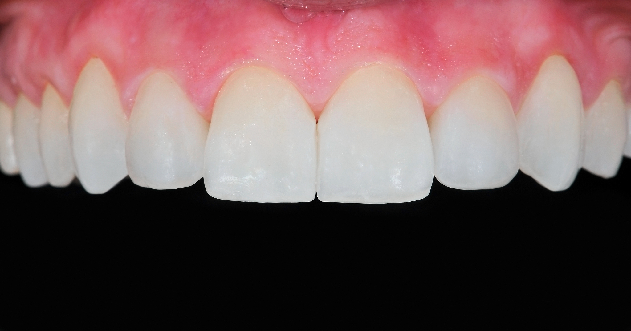 2019年云南新型职业学院口腔医学技术专业招生